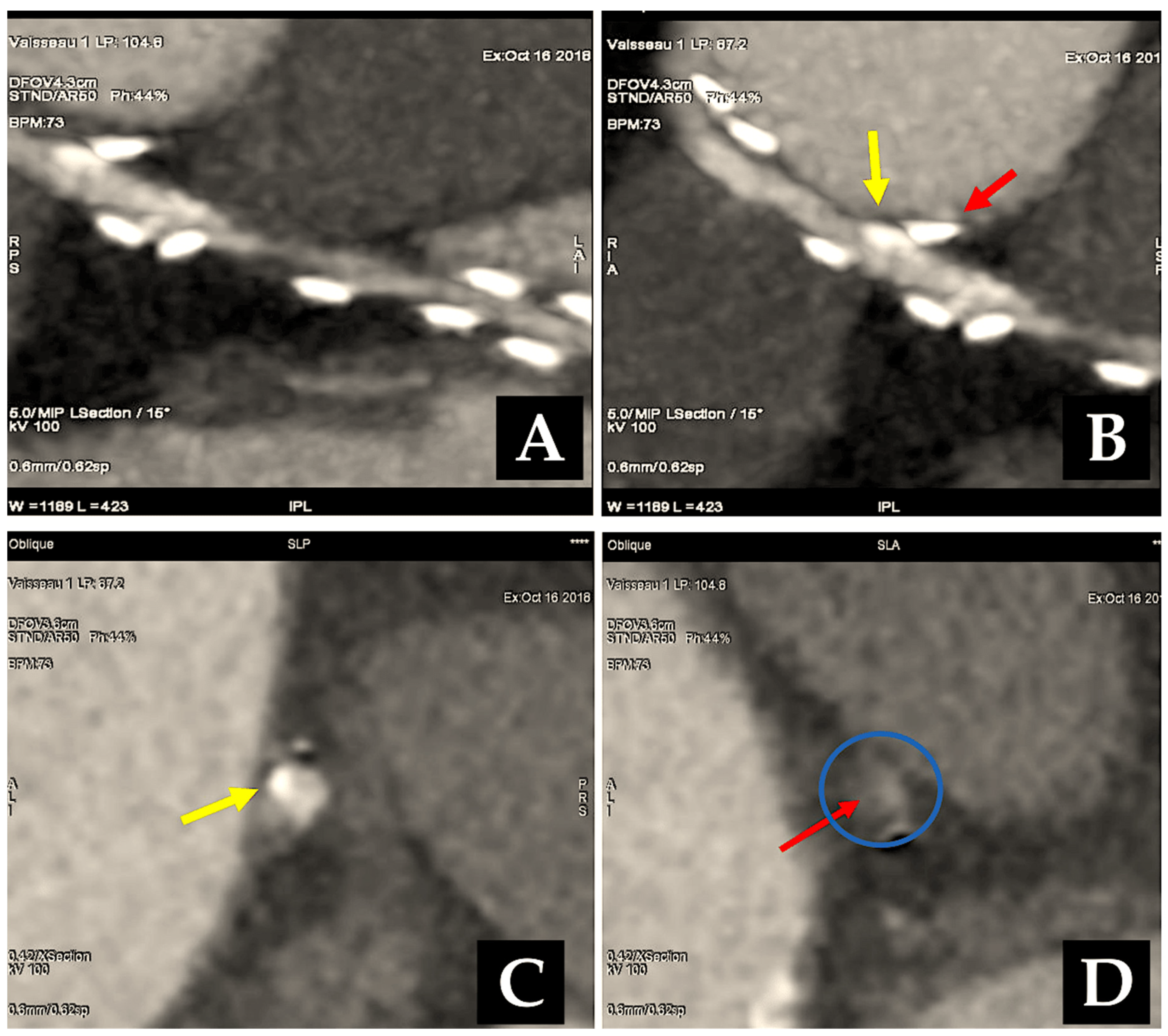 Surgeries 06 00006 g008 Surgeries 06 00006 g008