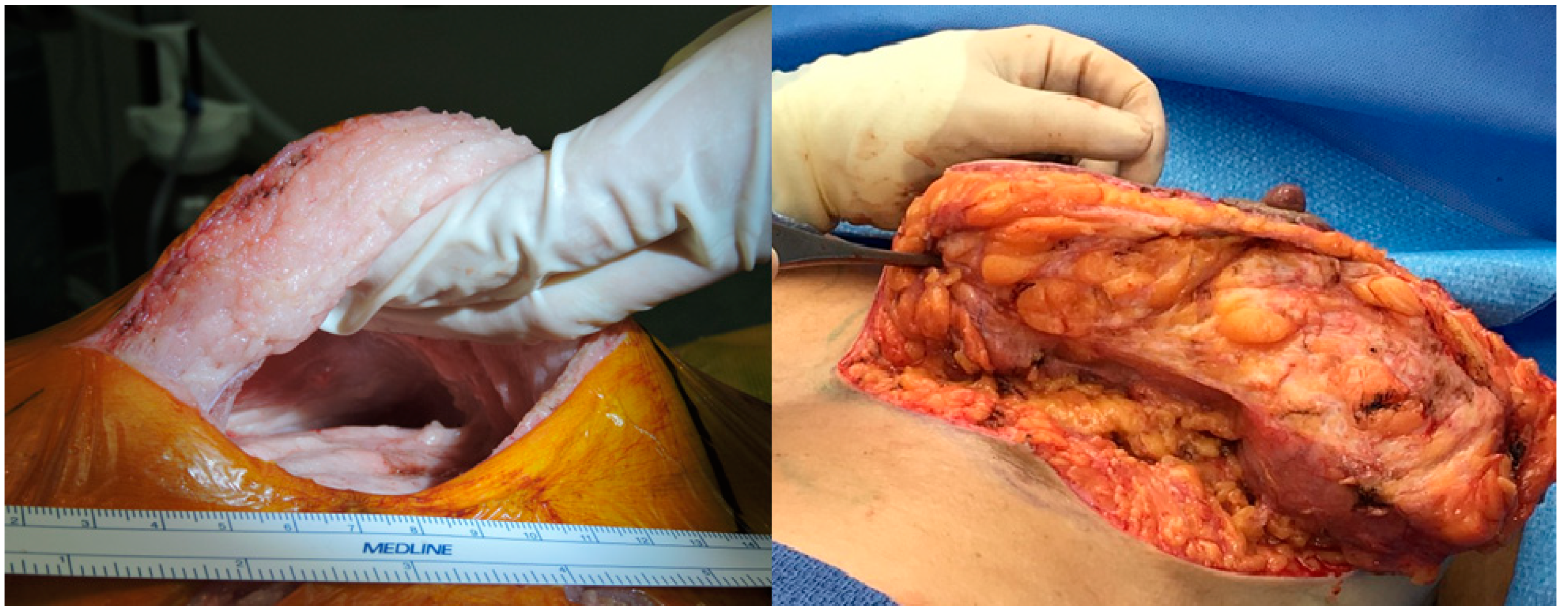 Surgeries 06 00011 g001