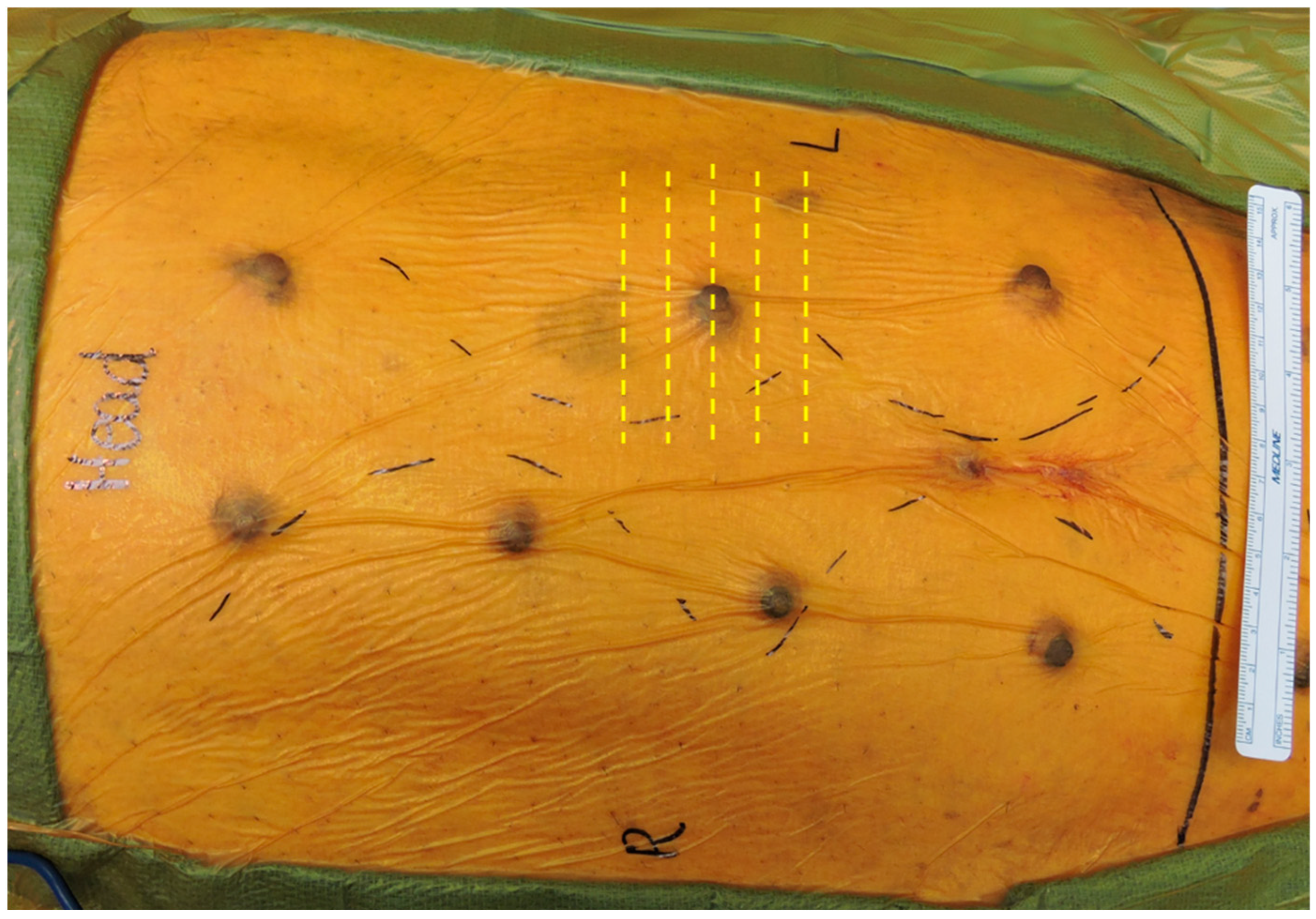 Surgeries 06 00011 g002