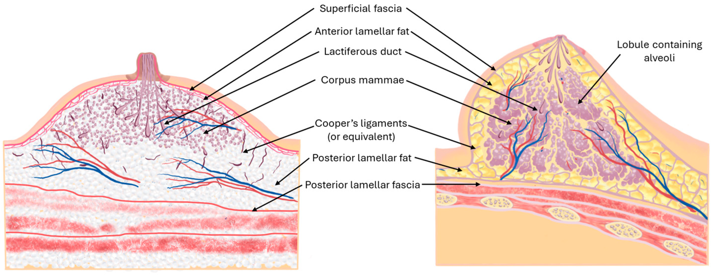 Surgeries 06 00011 g005