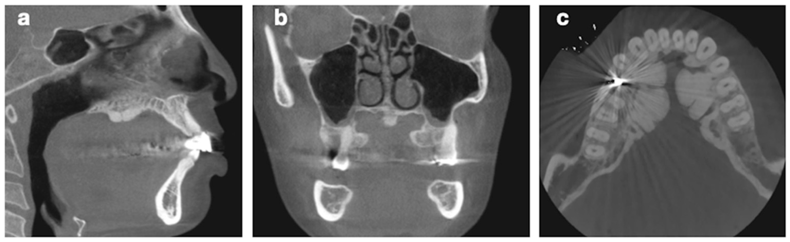 Surgeries 06 00017 g002