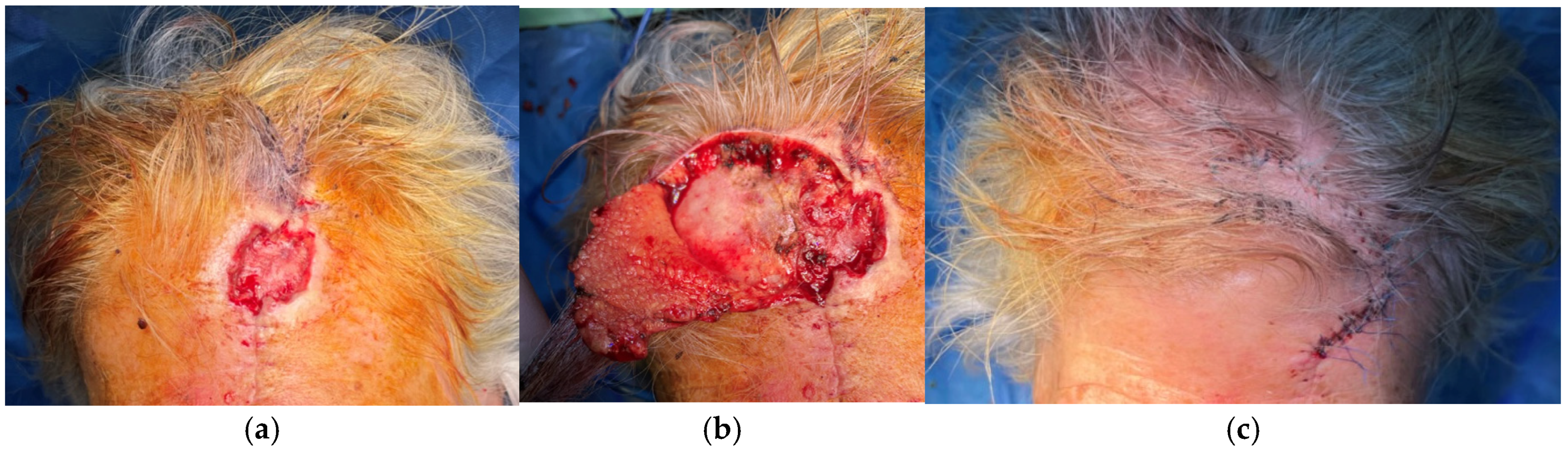 Surgeries 06 00018 g001