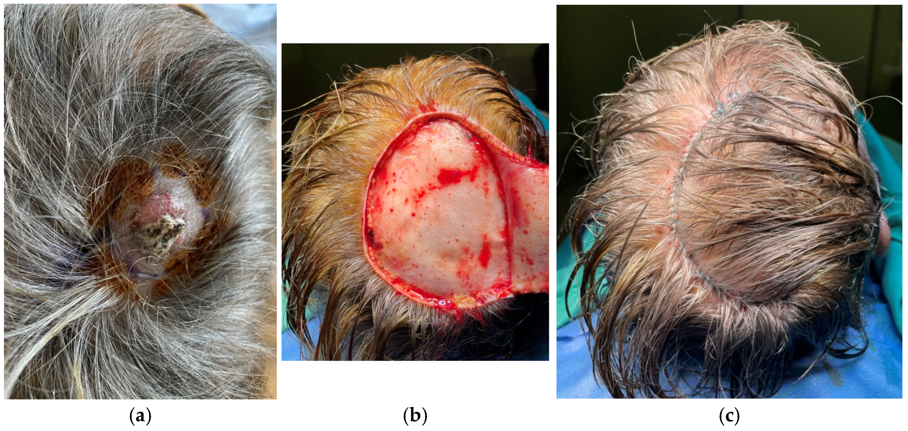 Surgeries 06 00018 g002