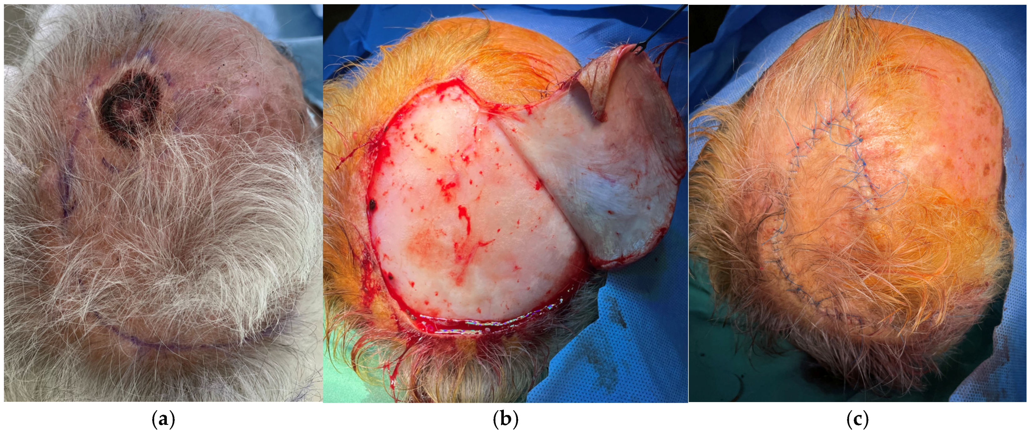 Surgeries 06 00018 g003