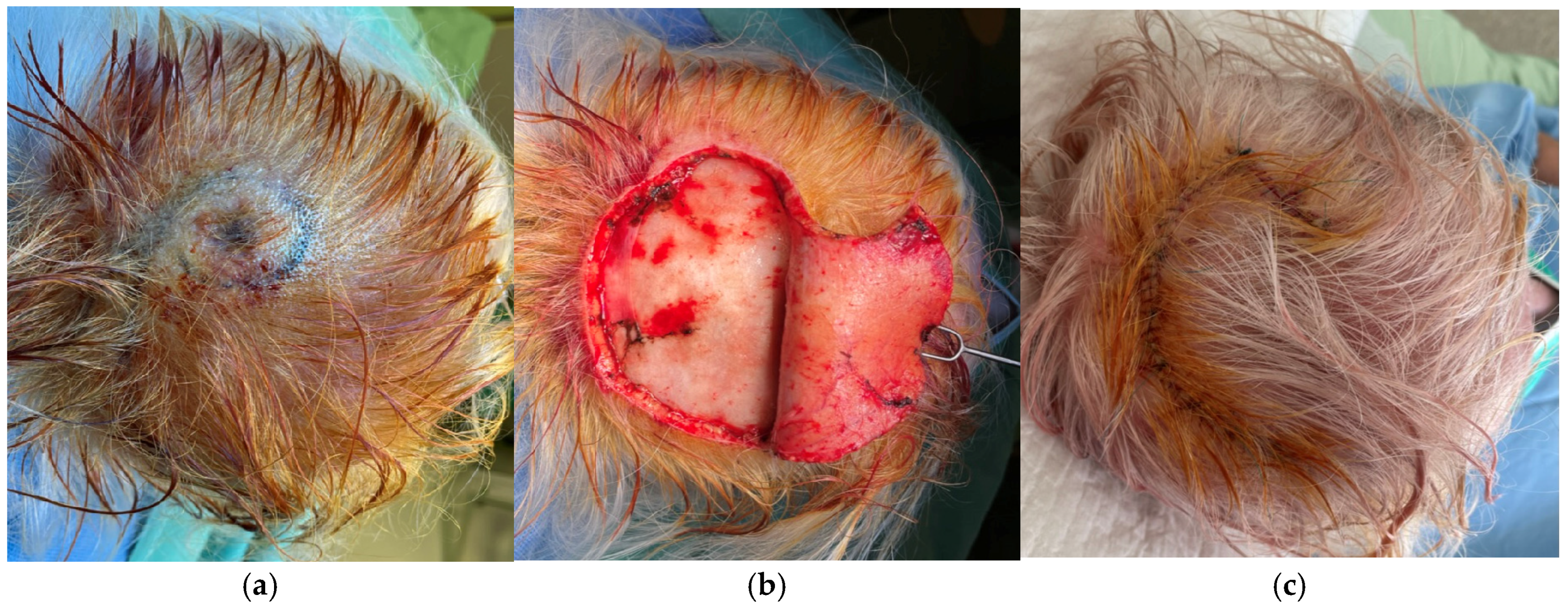 Surgeries 06 00018 g004