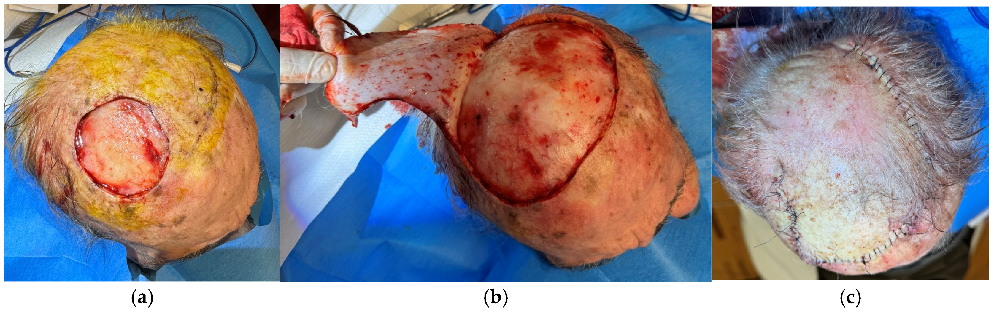 Surgeries 06 00018 g005