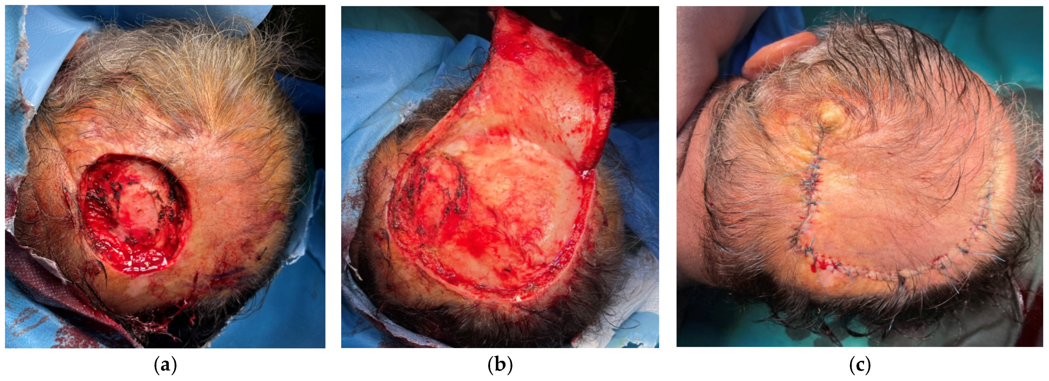 Surgeries 06 00018 g006
