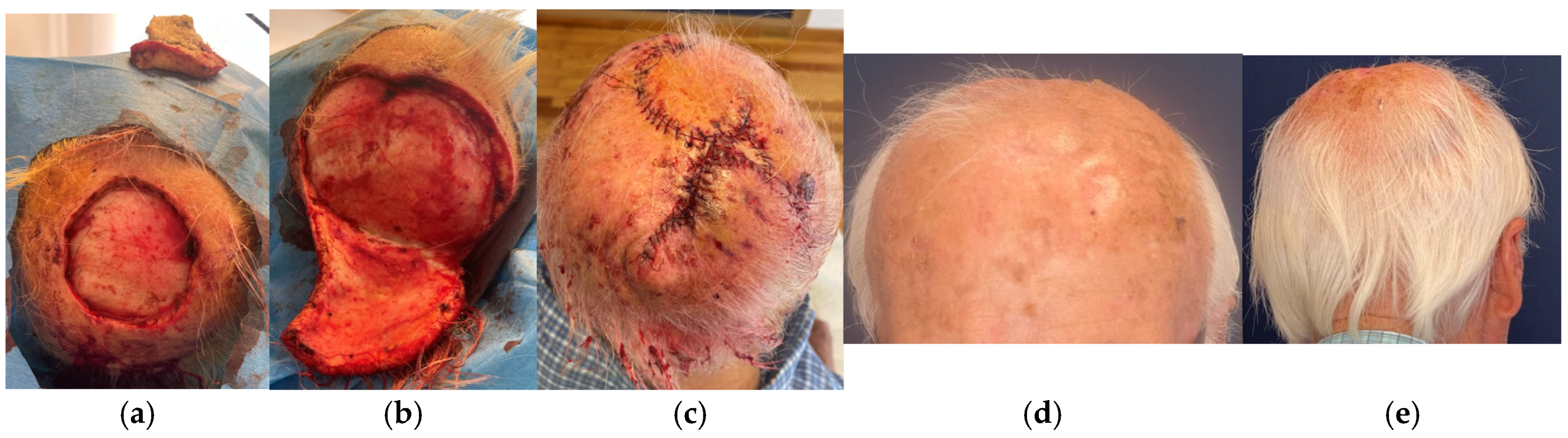 Surgeries 06 00018 g007