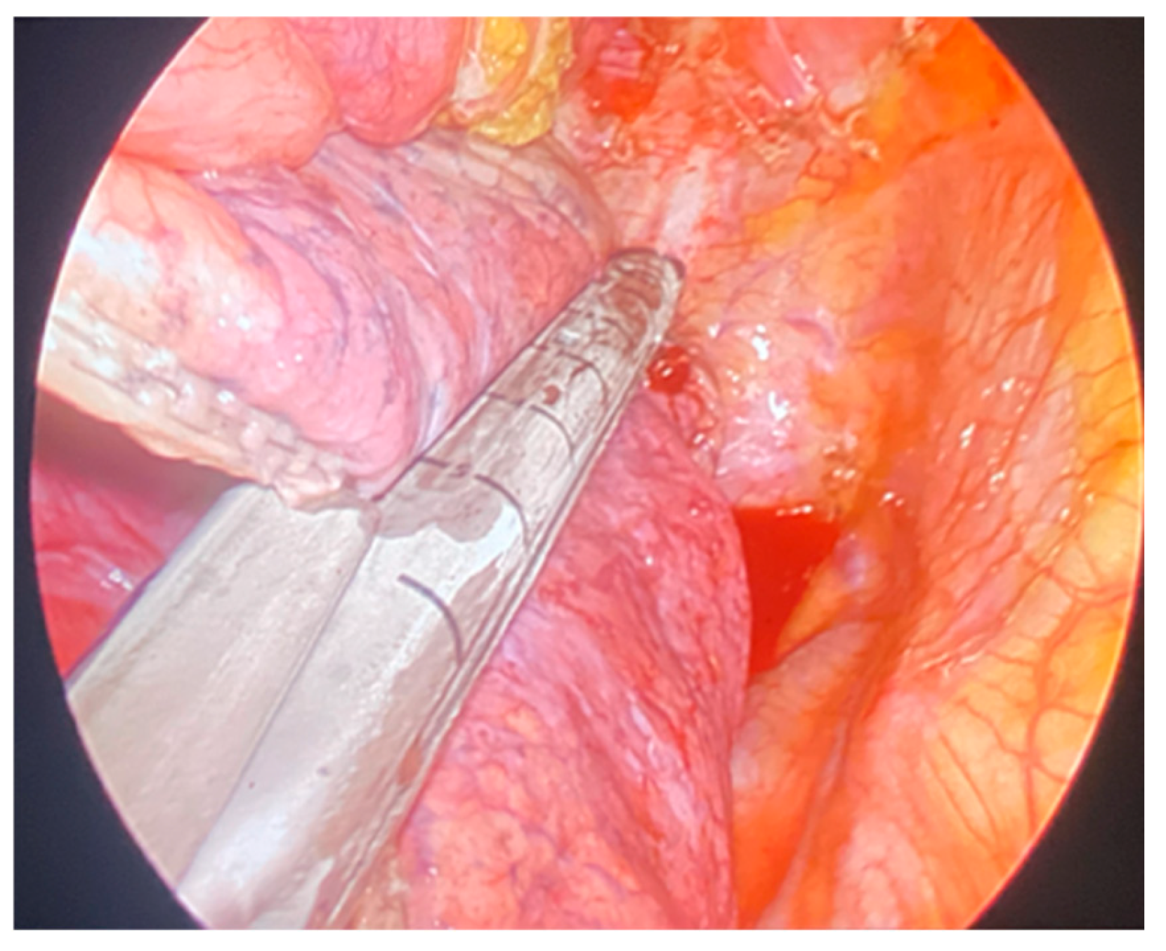 Surgeries 06 00029 g001