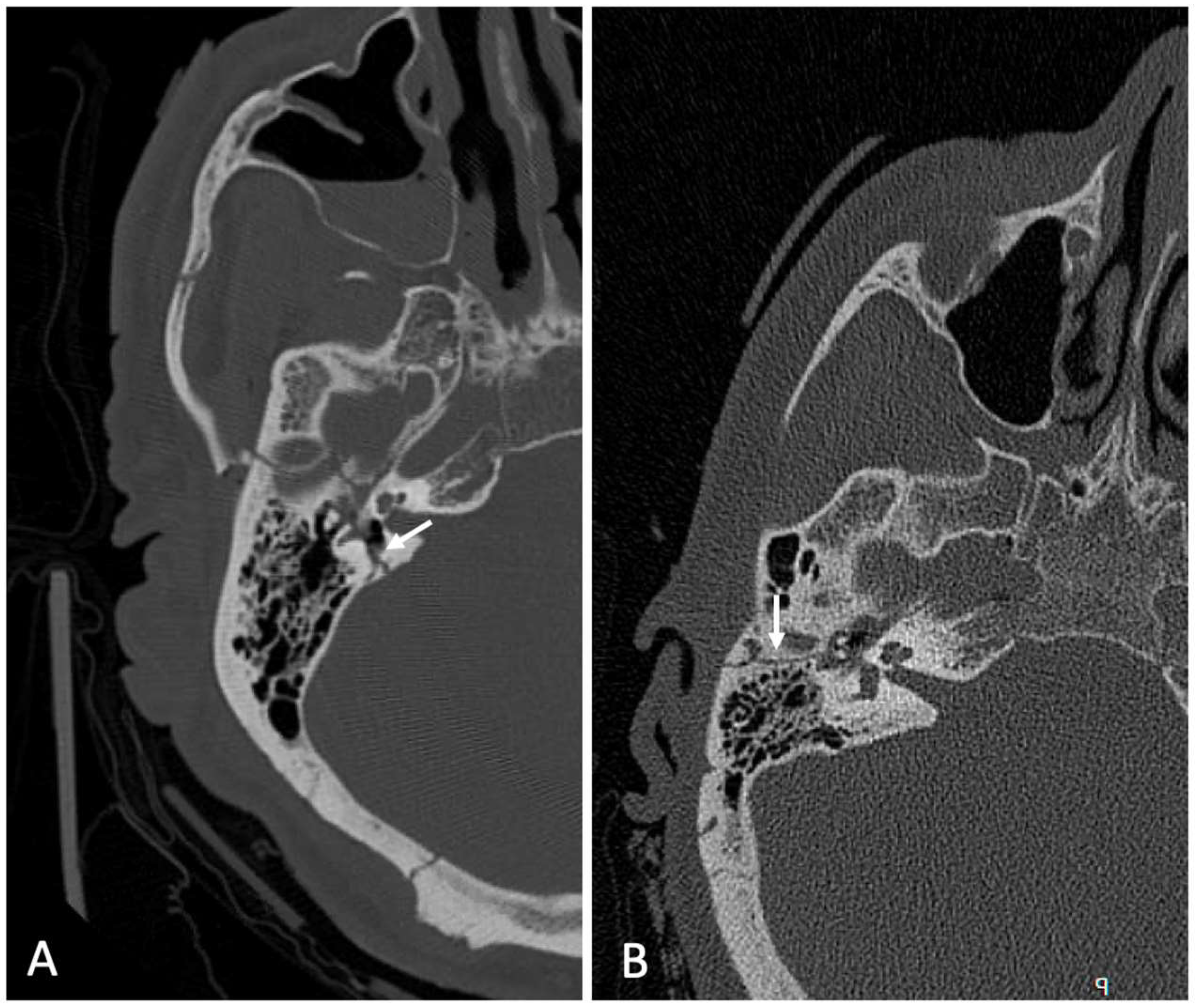 Surgeries 06 00033 g002