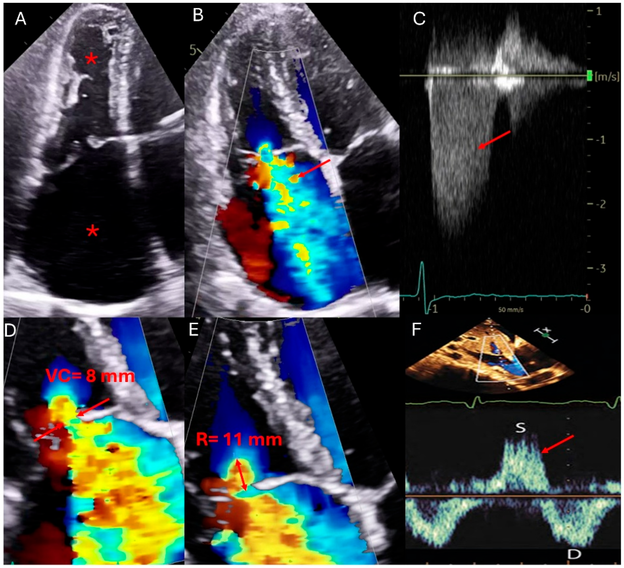 Surgeries 06 00039 g001 Surgeries 06 00039 g001