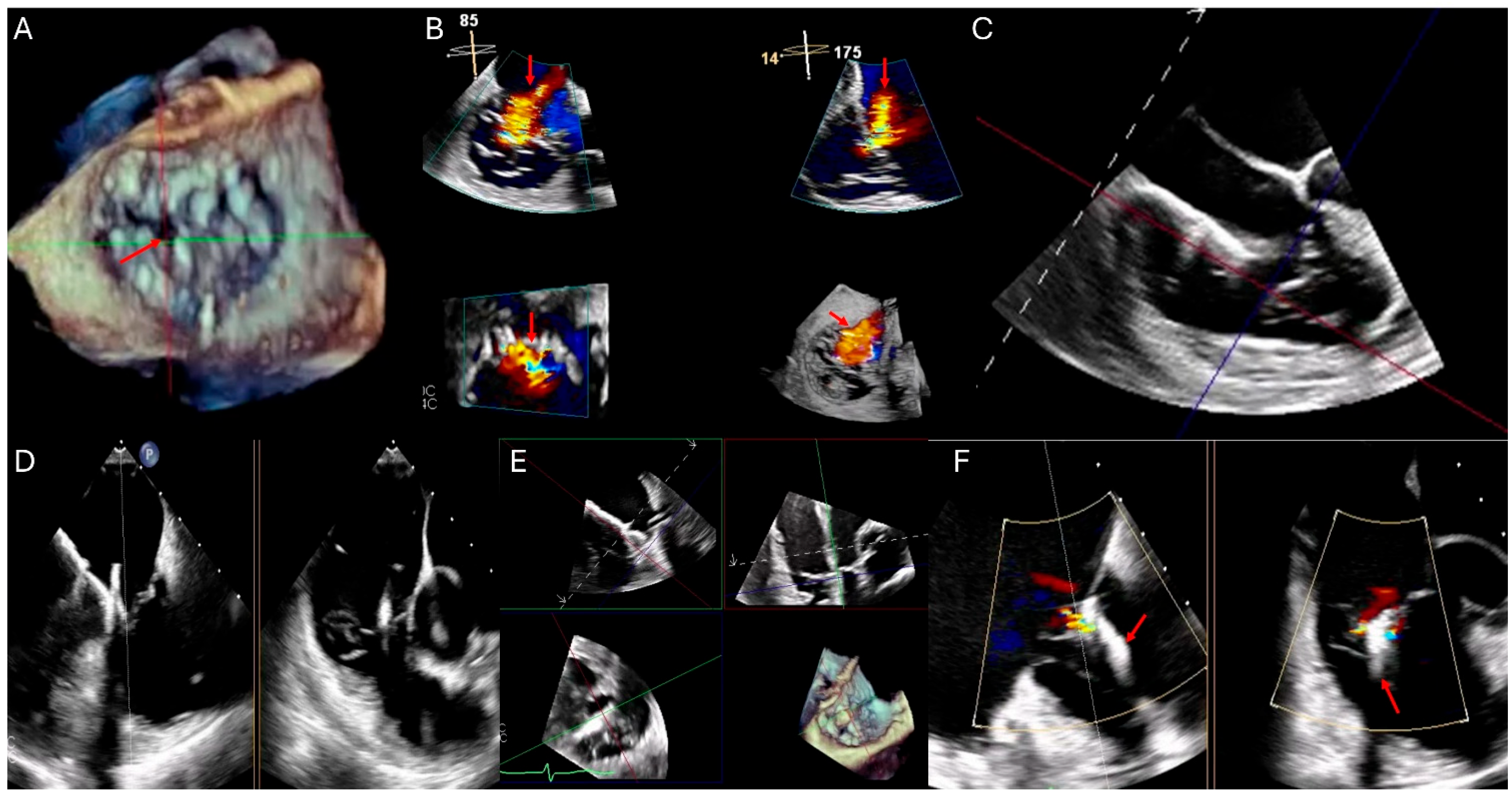 Surgeries 06 00039 g002 Surgeries 06 00039 g002