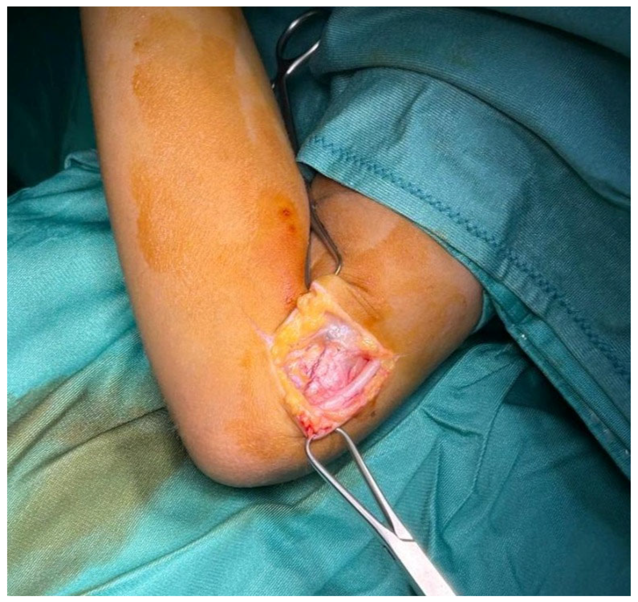 Surgeries 06 00049 g001 Surgeries 06 00049 g001