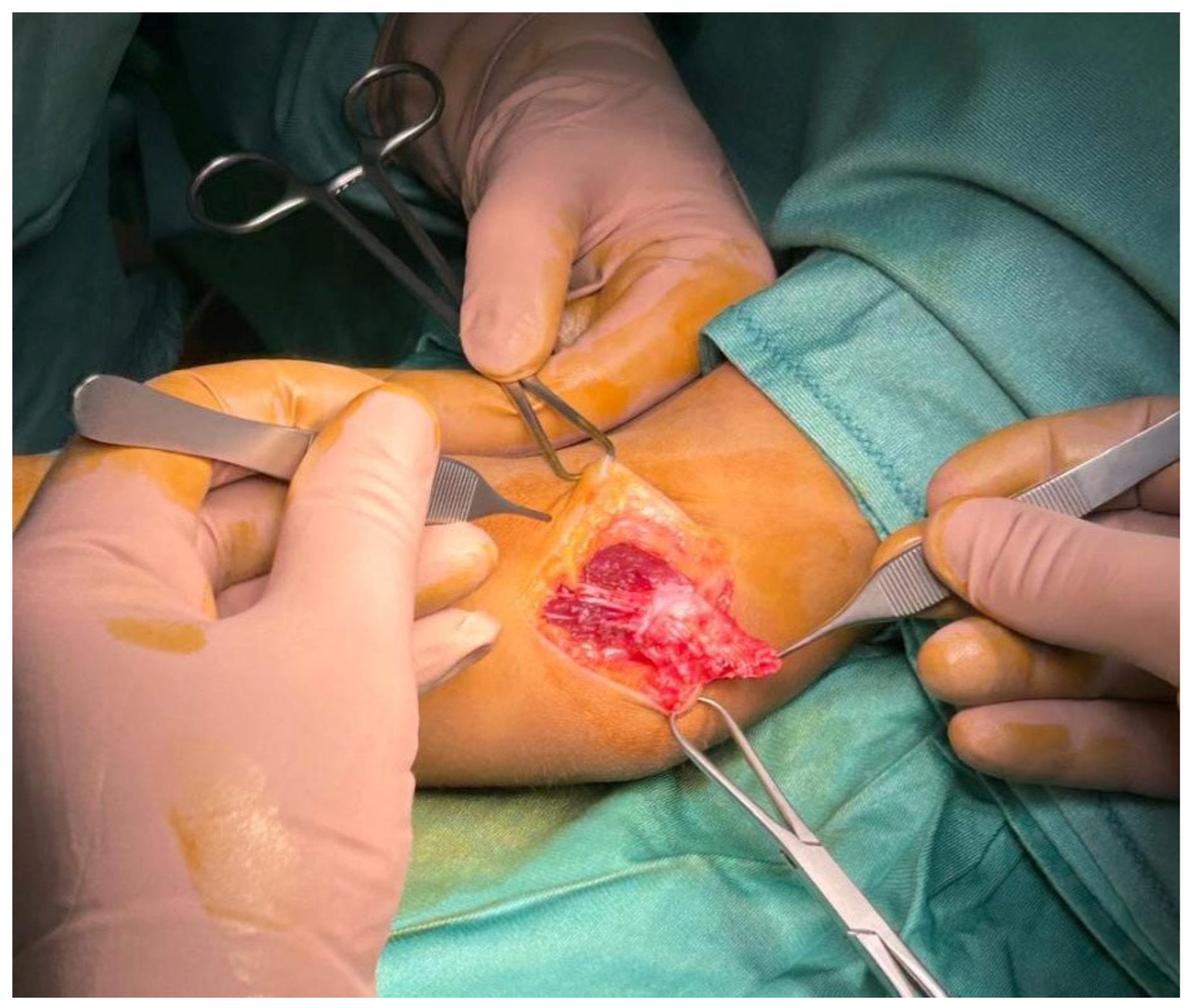 Surgeries 06 00049 g002 Surgeries 06 00049 g002