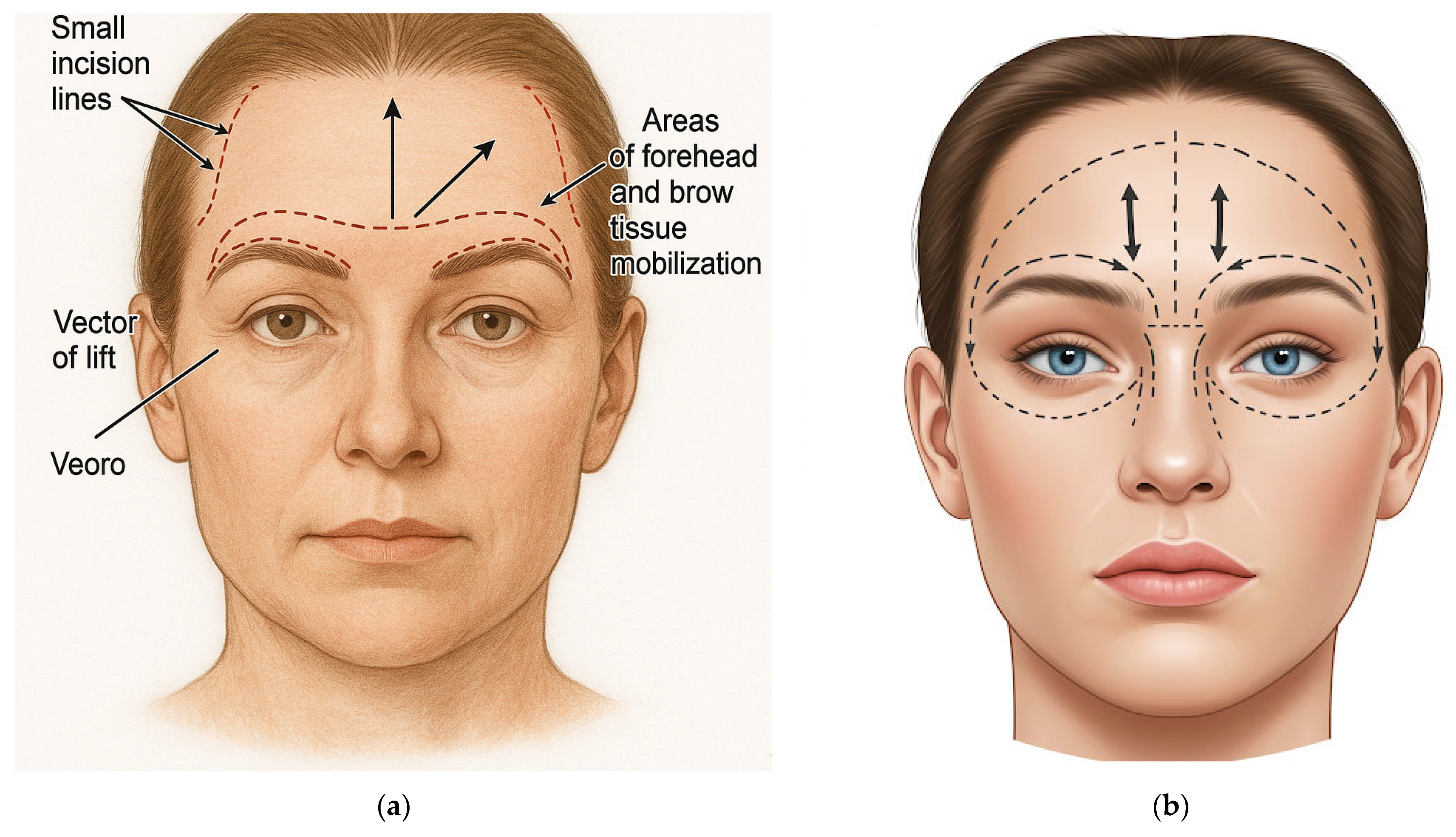 Surgeries 06 00051 g002