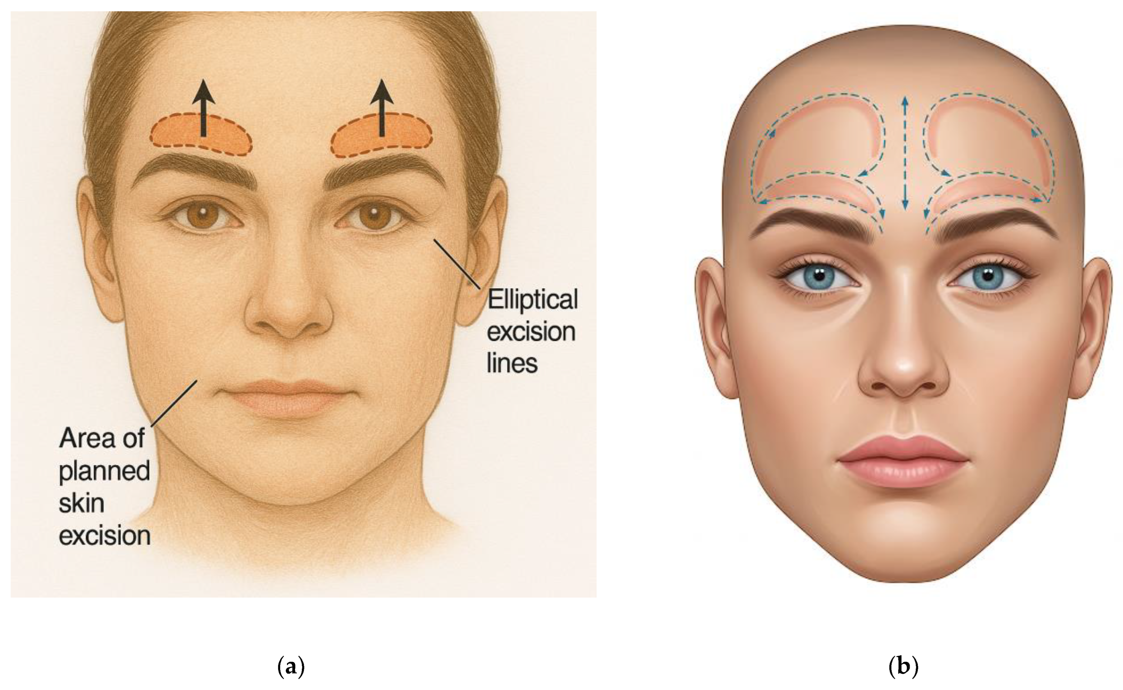 Surgeries 06 00051 g004
