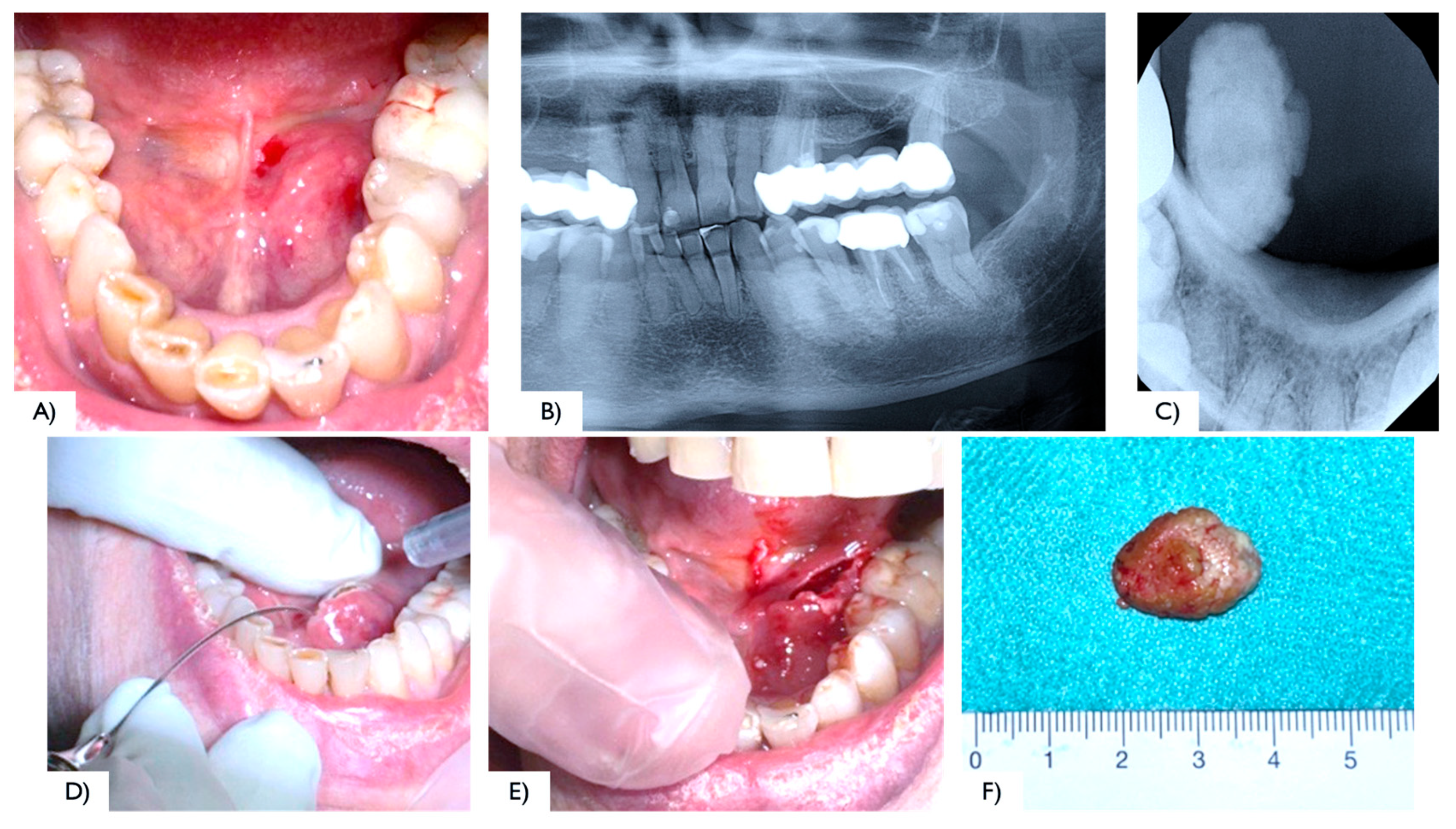 Surgeries 06 00053 g004