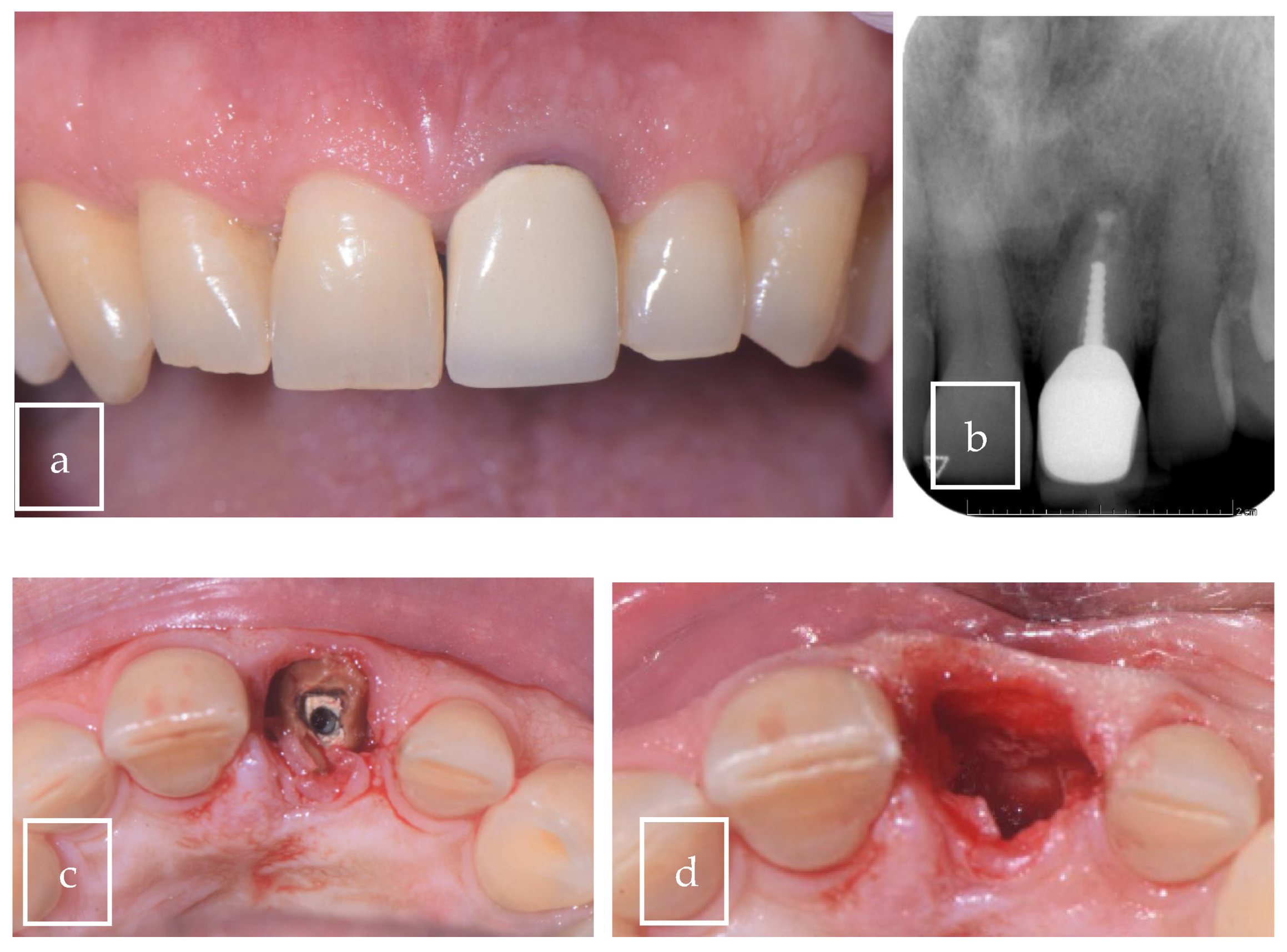 Surgeries 06 00056 g002a