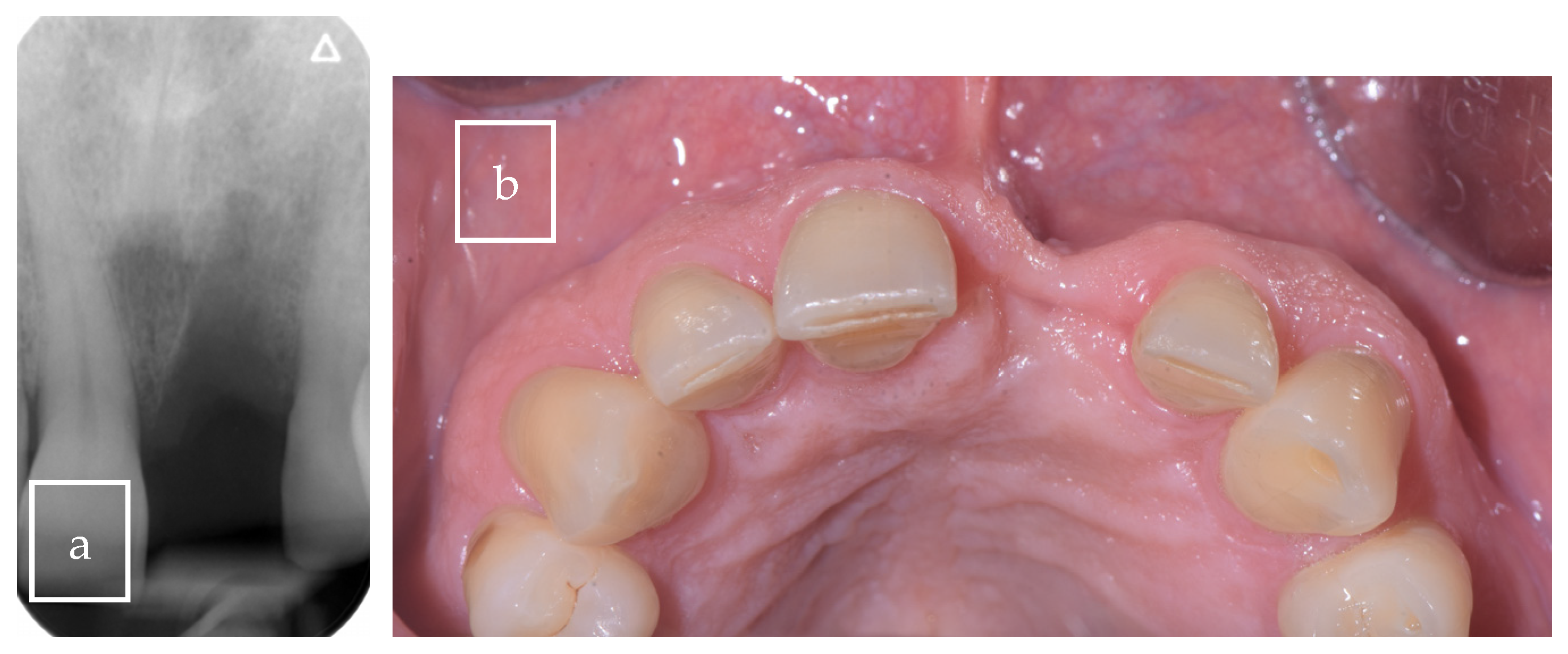 Surgeries 06 00056 g003