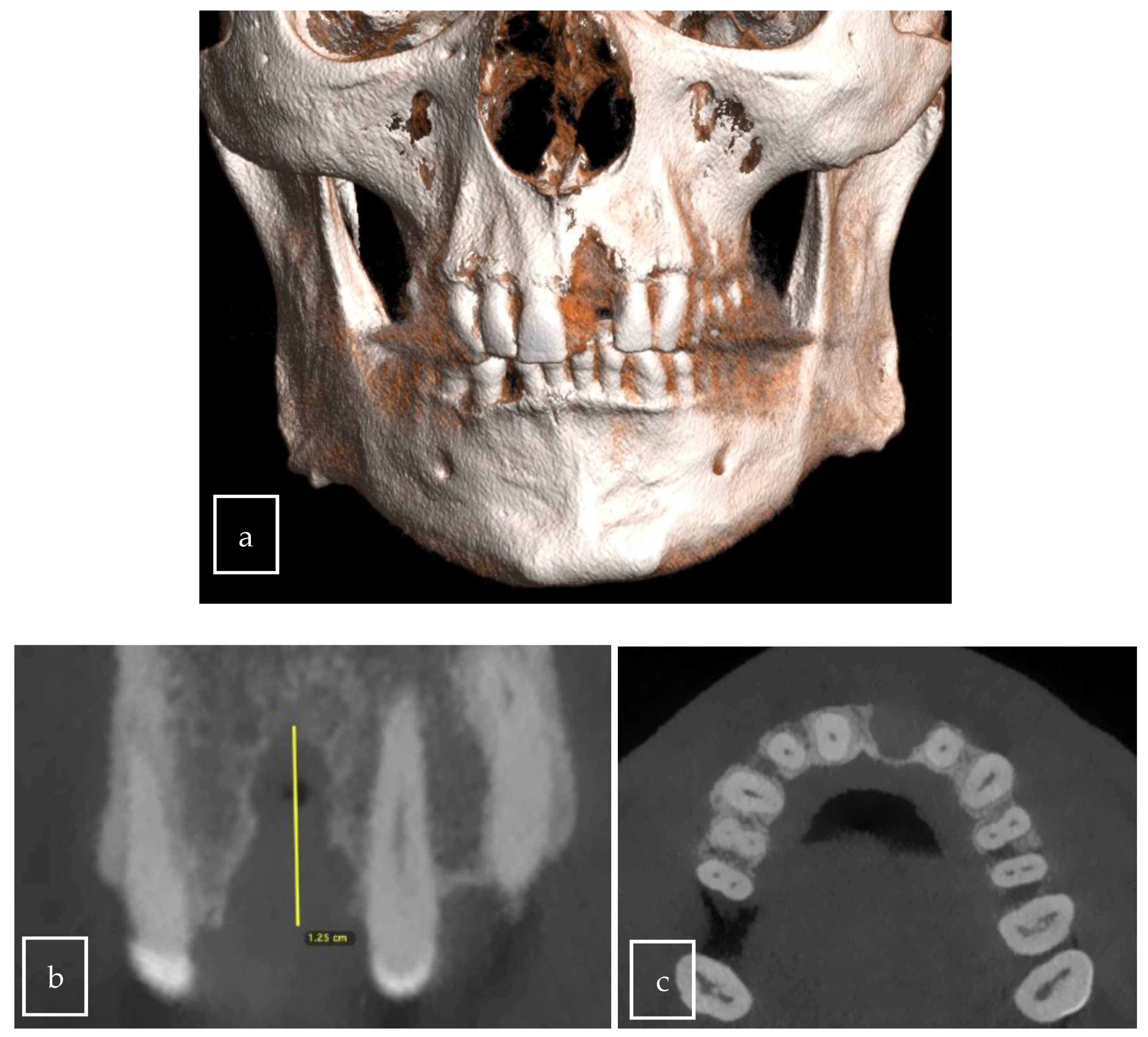Surgeries 06 00056 g004