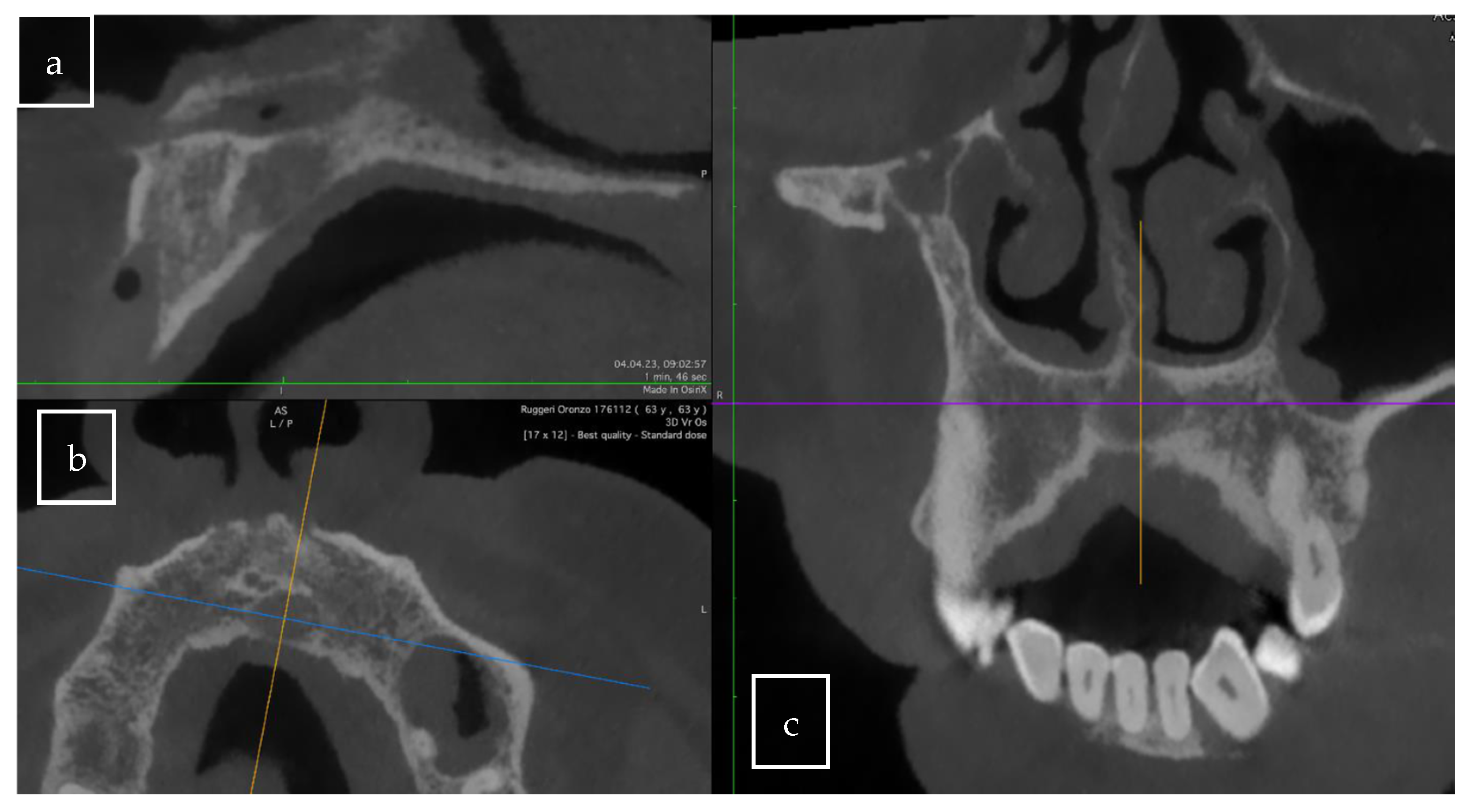 Surgeries 06 00056 g005