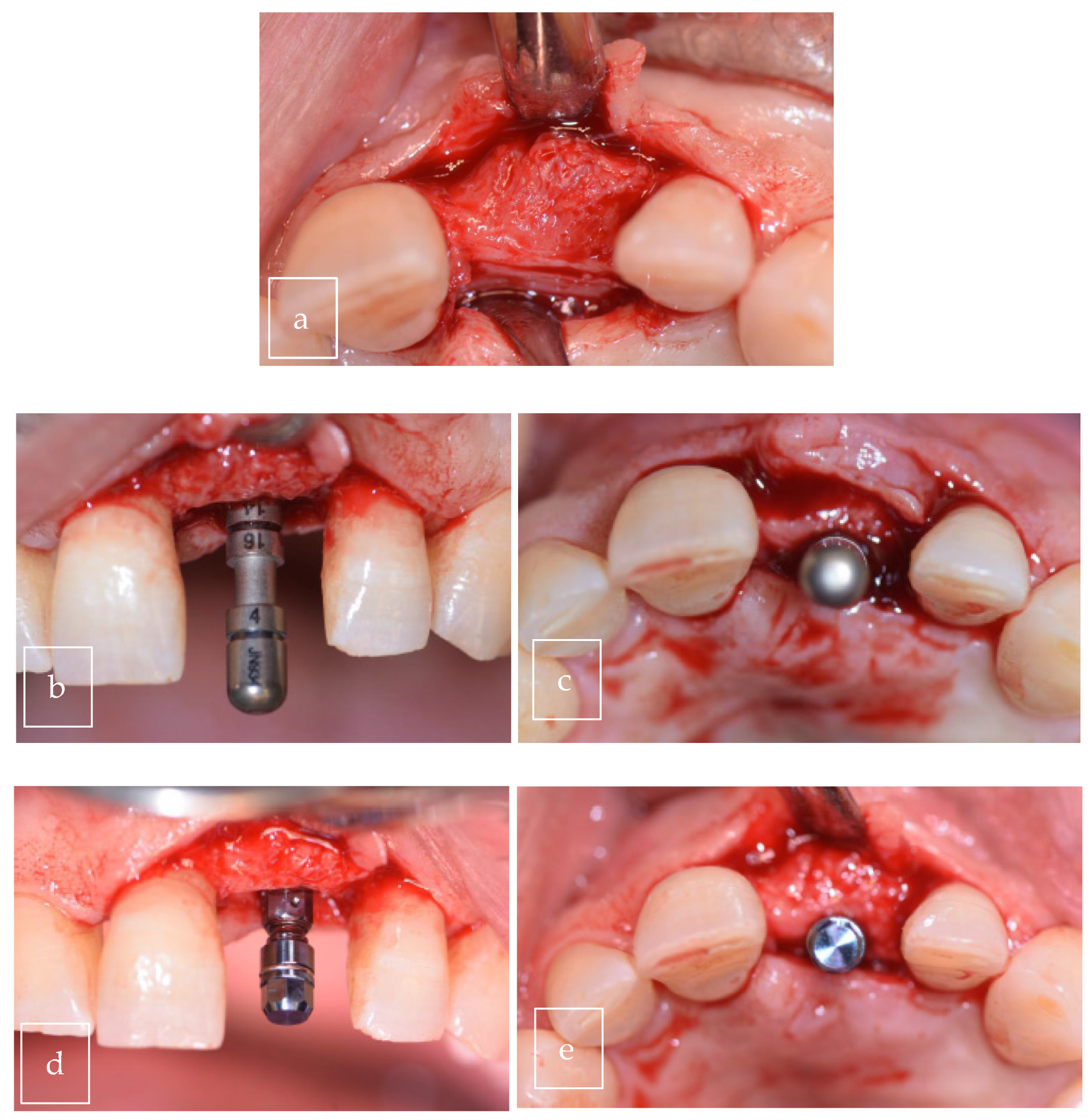 Surgeries 06 00056 g009