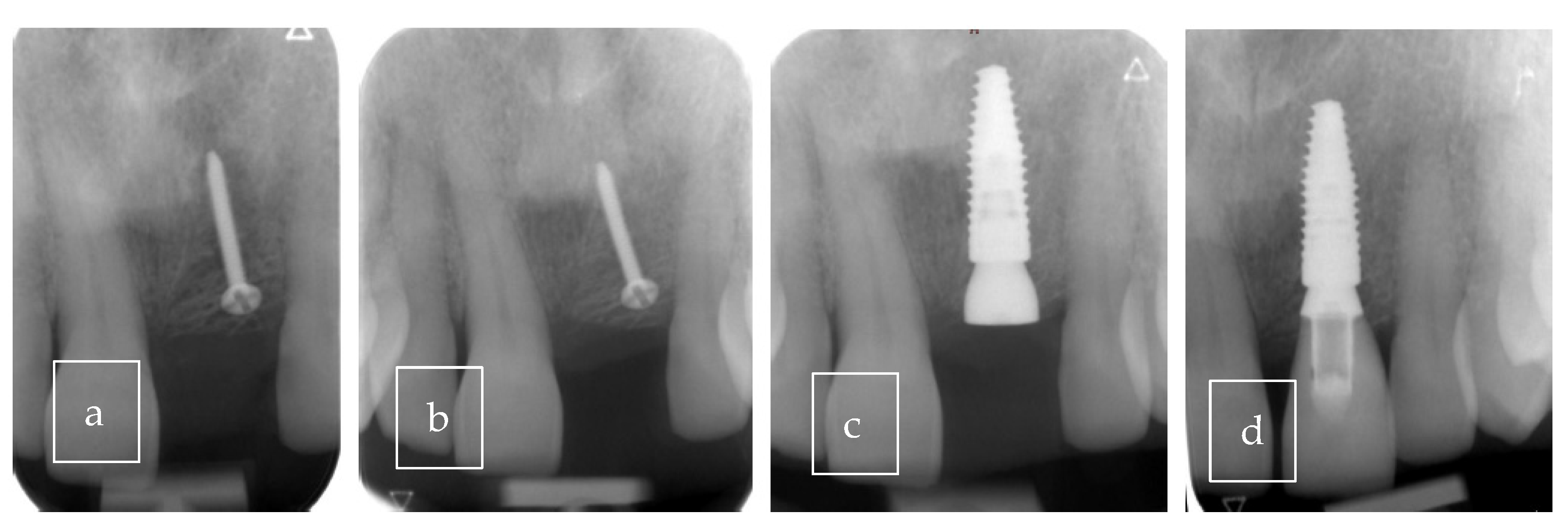 Surgeries 06 00056 g010