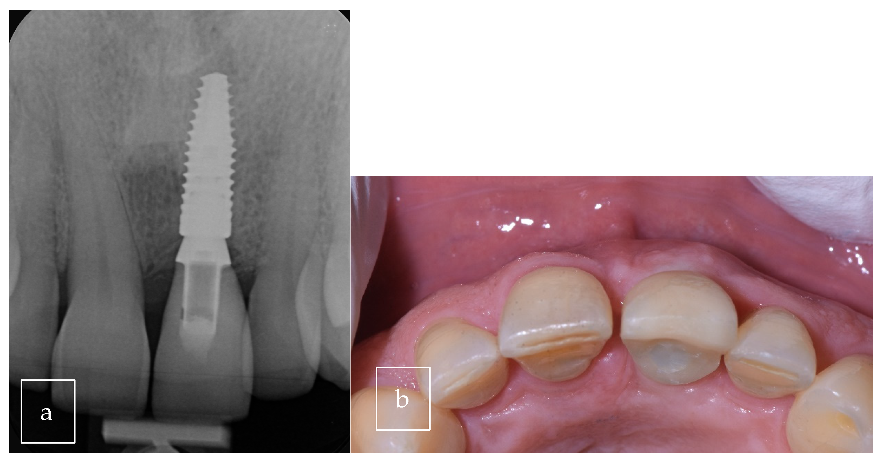 Surgeries 06 00056 g011