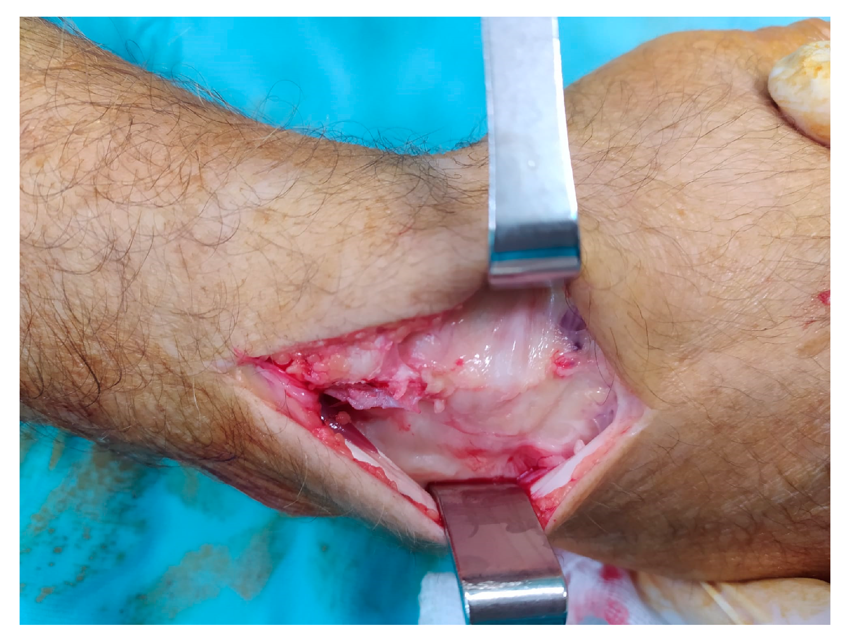 Surgeries 06 00057 g002