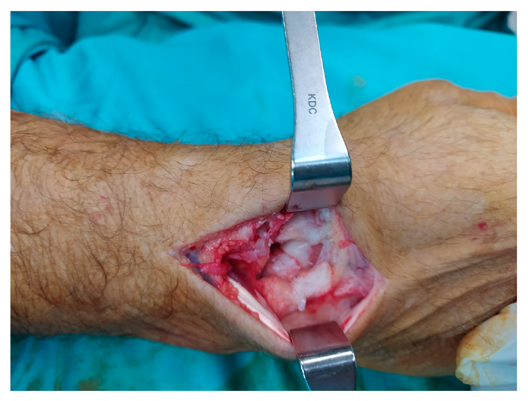 Surgeries 06 00057 g003