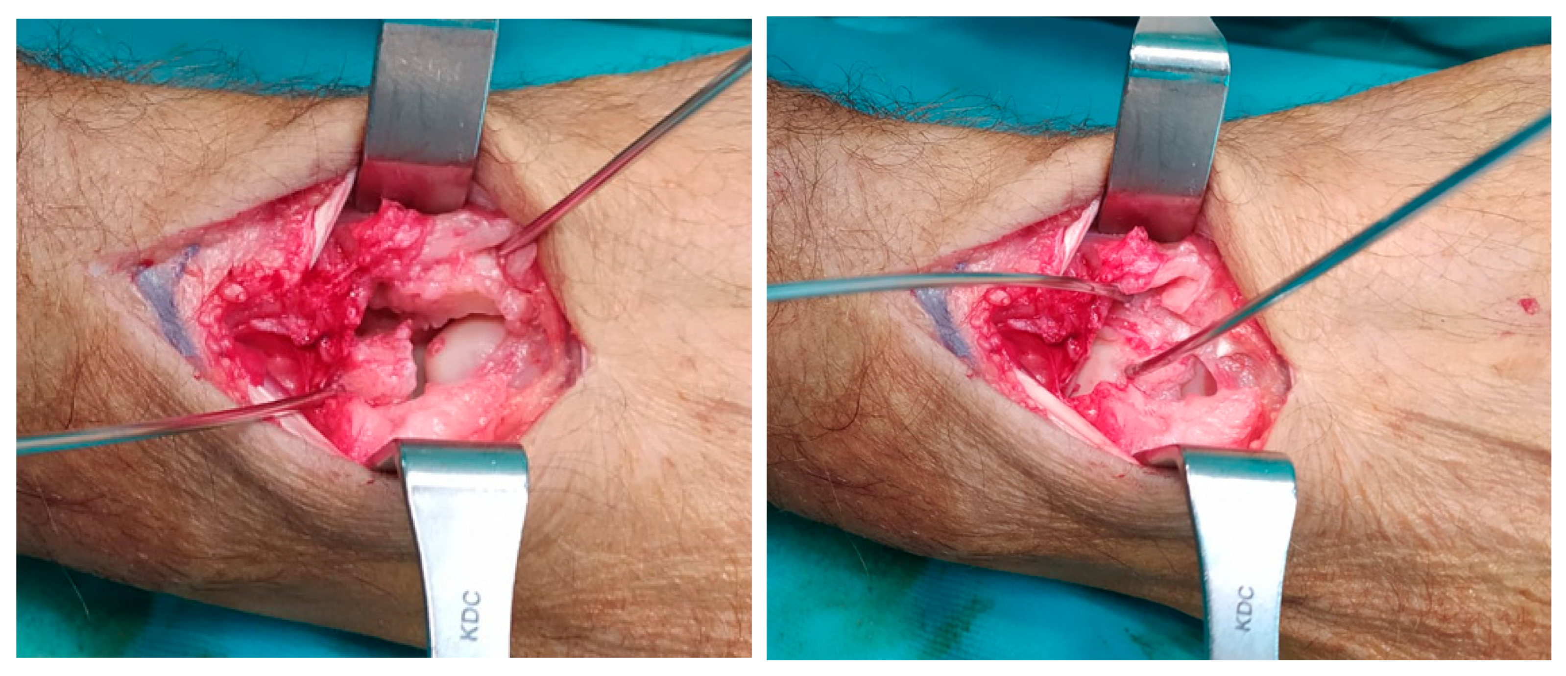 Surgeries 06 00057 g004