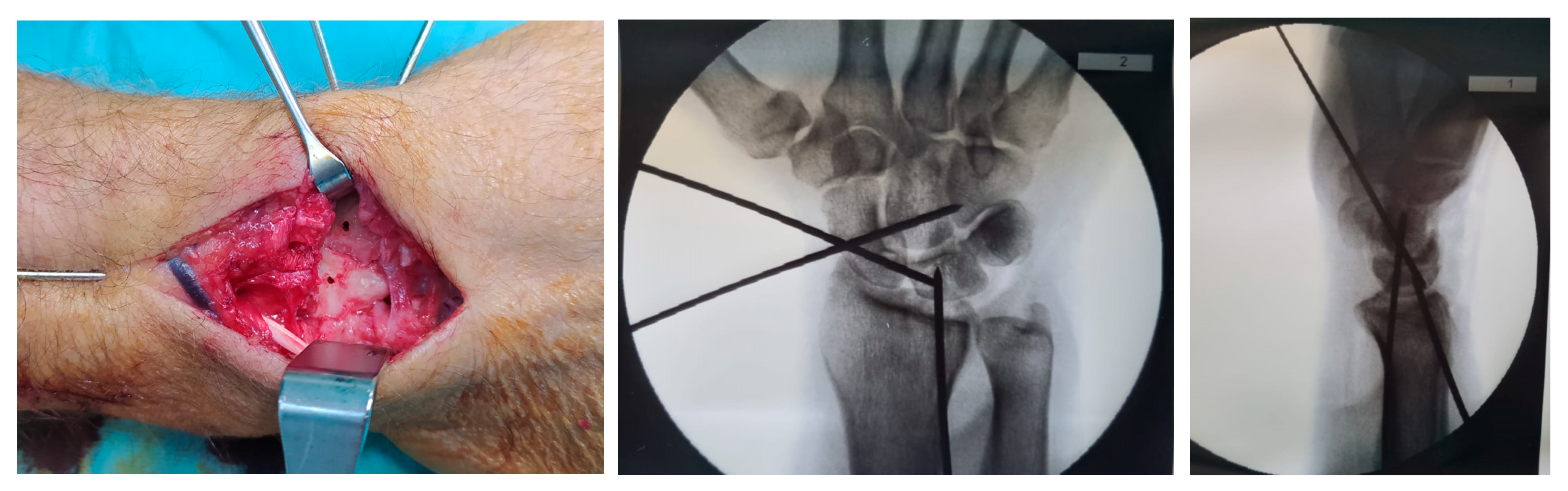 Surgeries 06 00057 g006