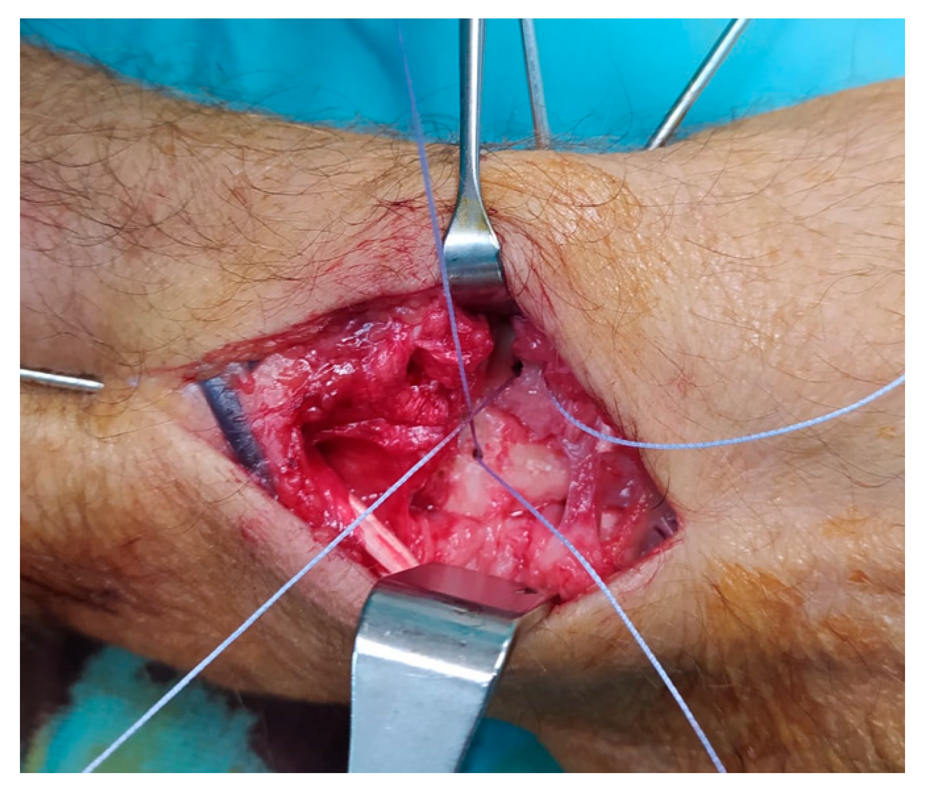 Surgeries 06 00057 g007