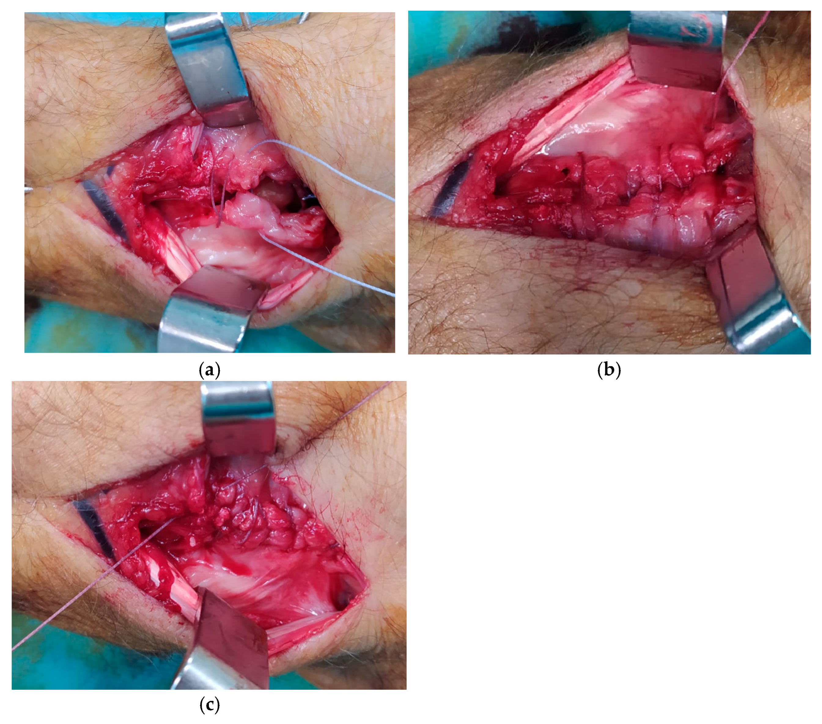 Surgeries 06 00057 g009