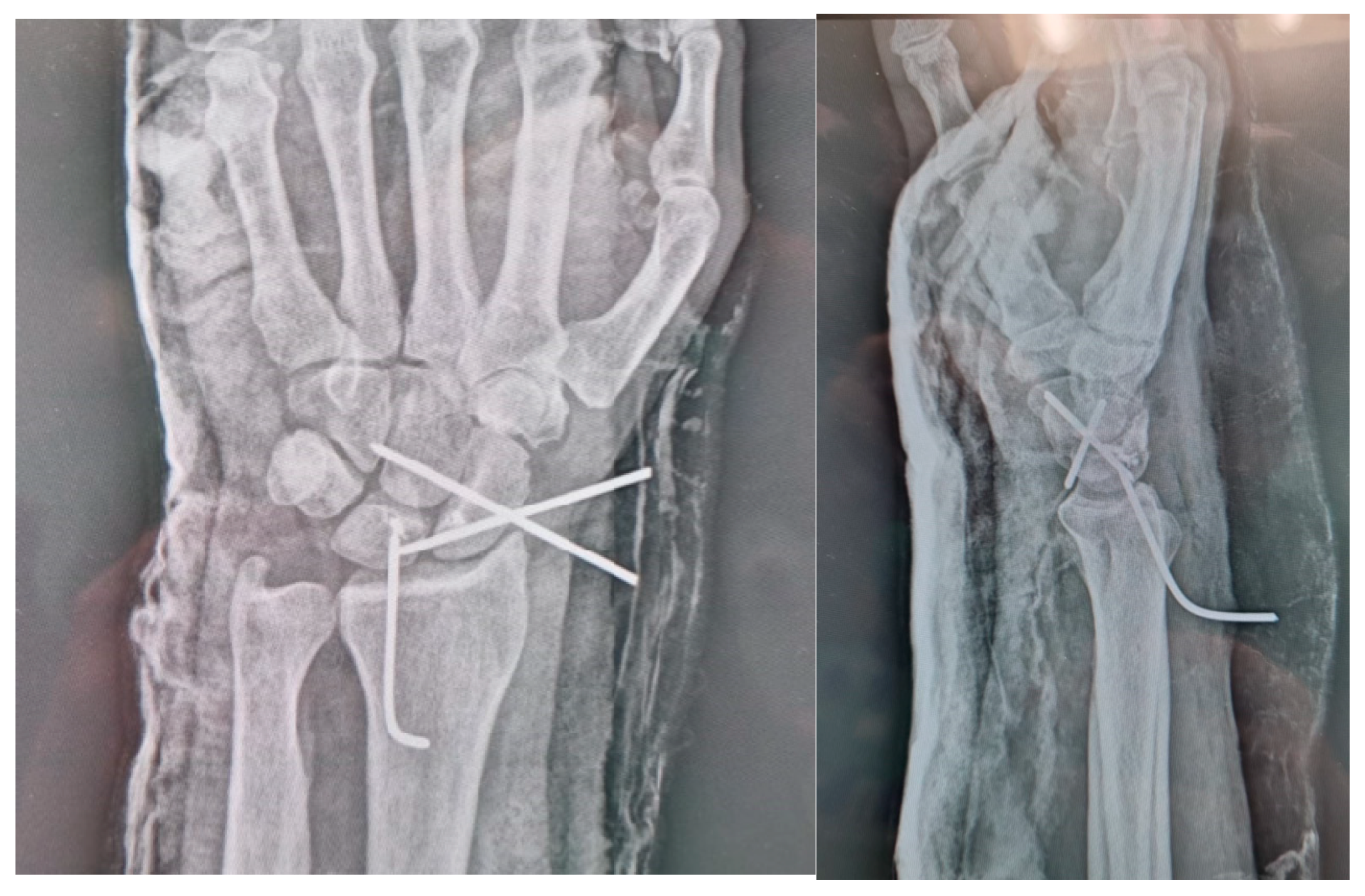 Surgeries 06 00057 g010