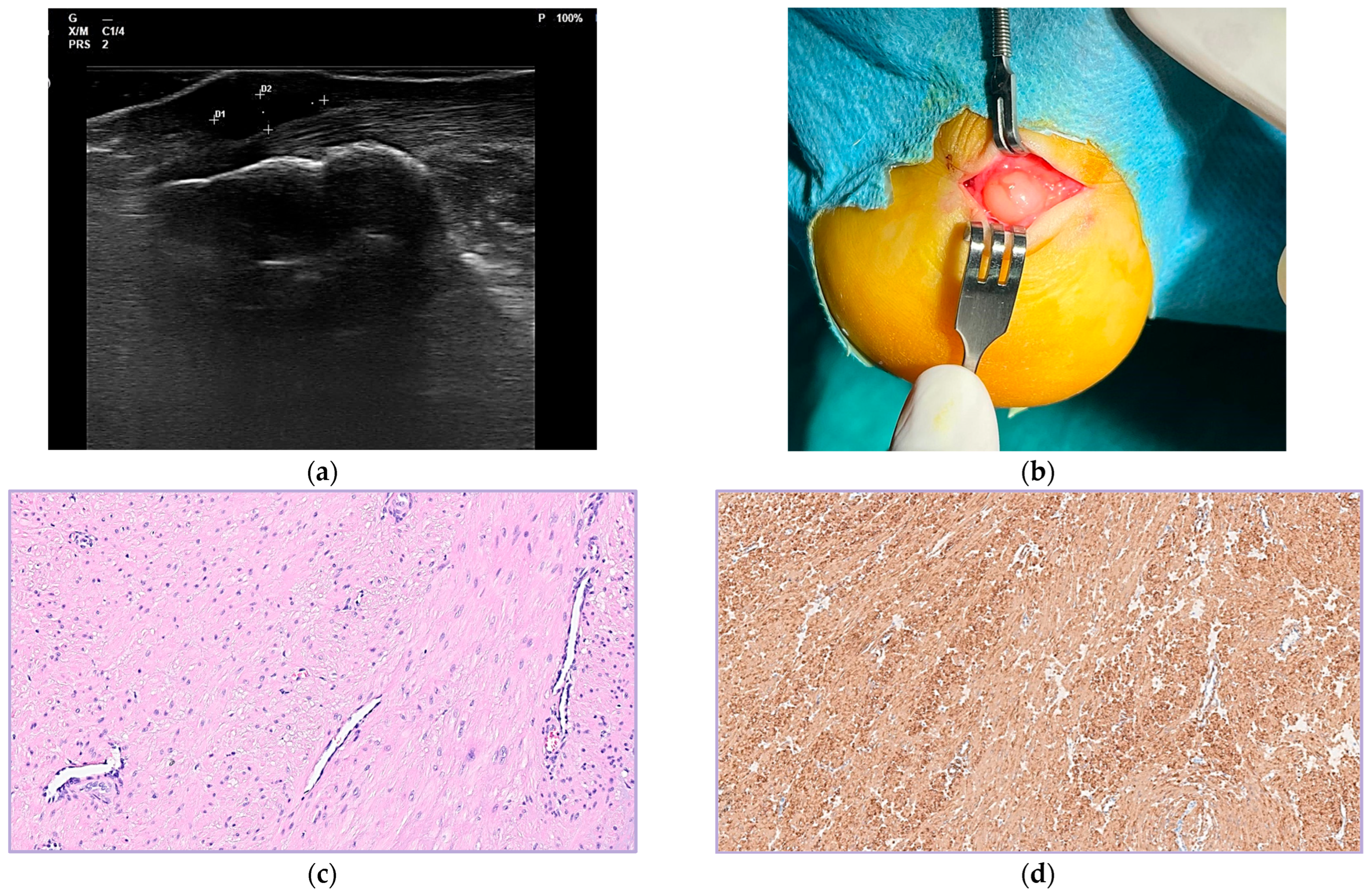 Surgeries 06 00066 g001