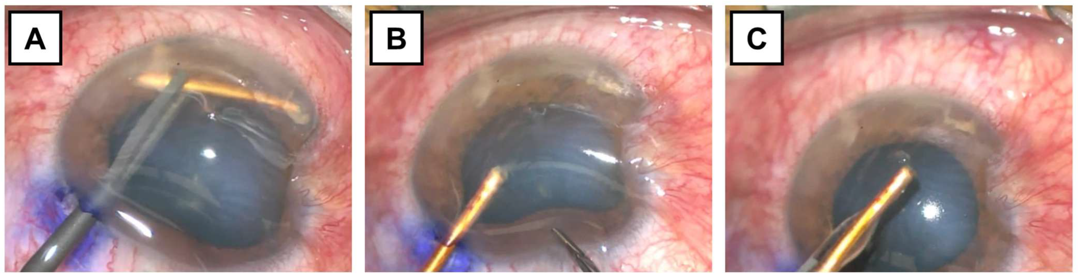 Surgeries 06 00068 g003