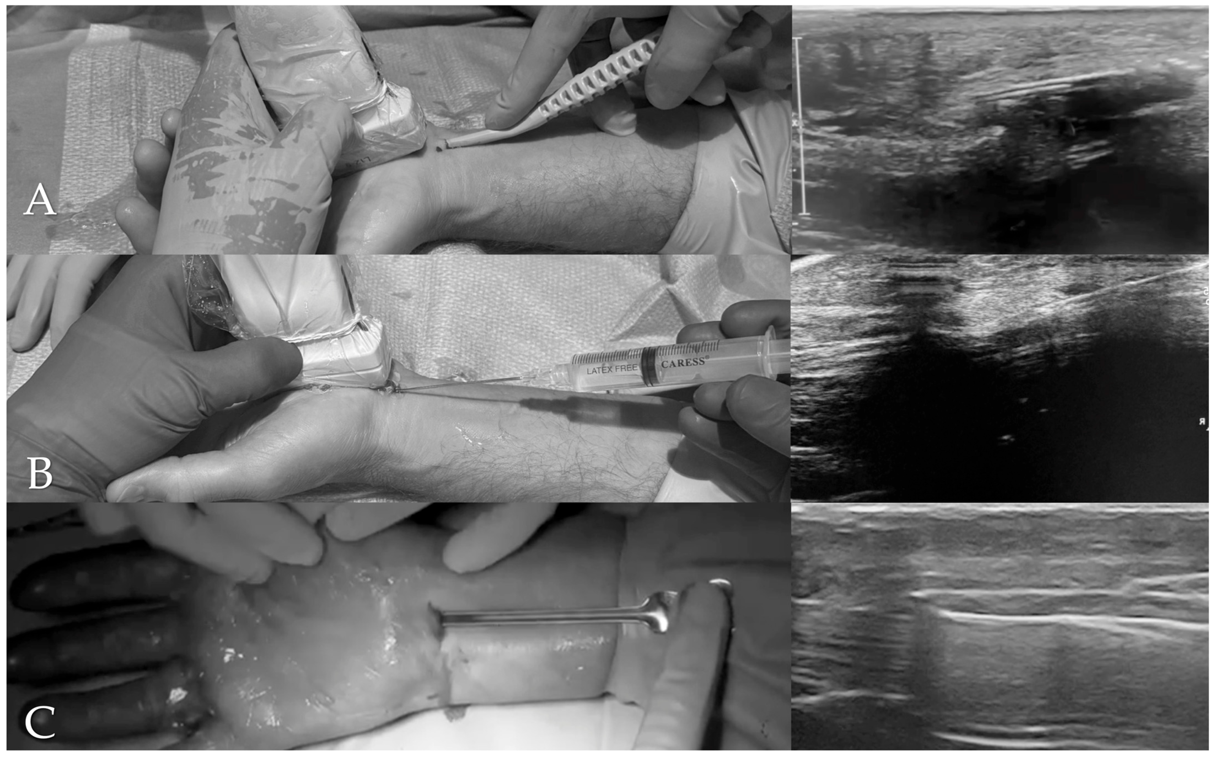 Surgeries 06 00092 g001