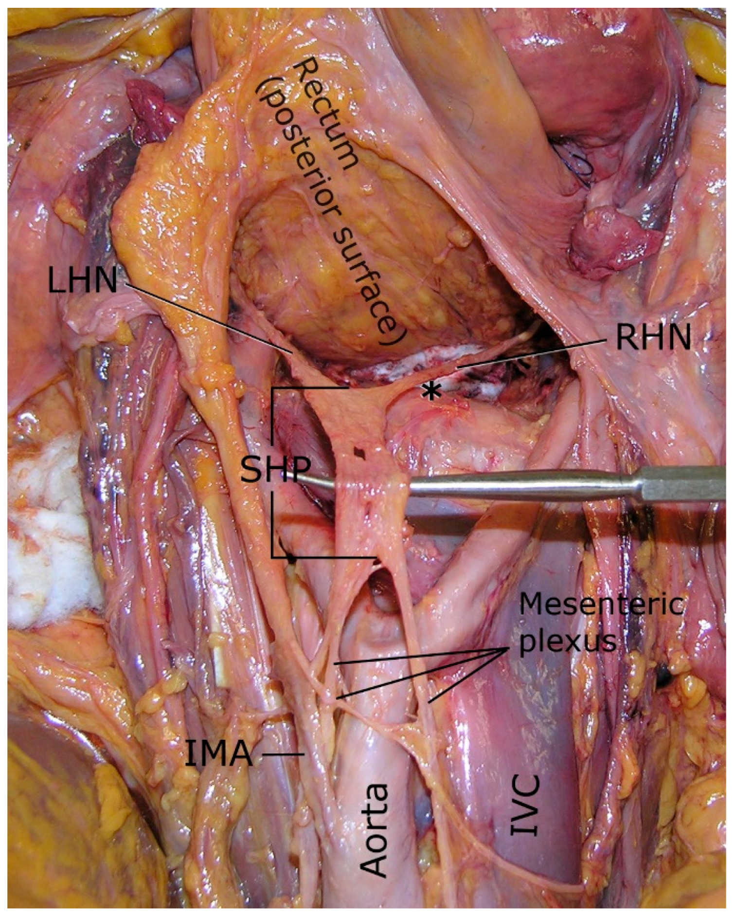 Surgeries 06 00094 g002 Surgeries 06 00094 g002