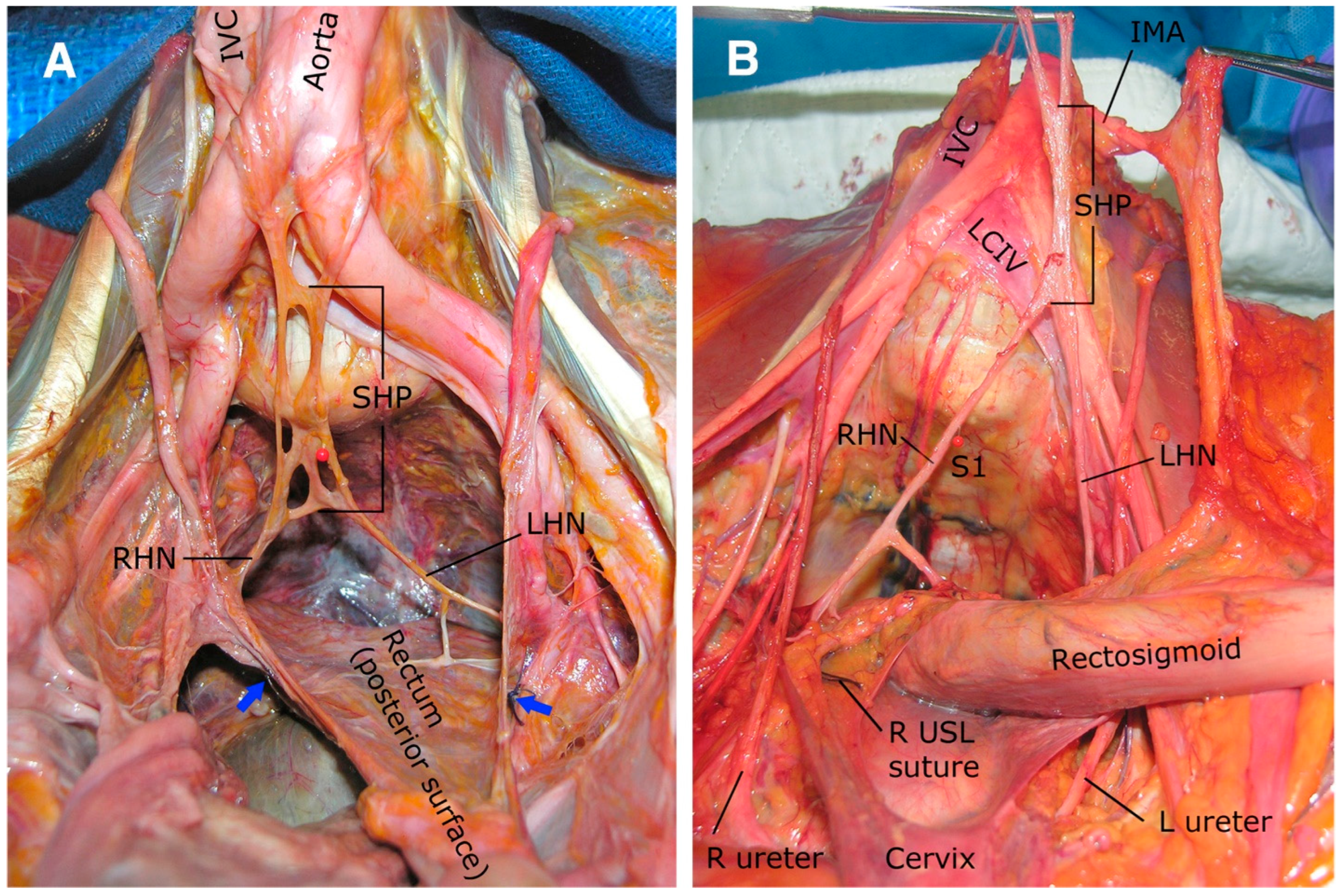 Surgeries 06 00094 g003 Surgeries 06 00094 g003
