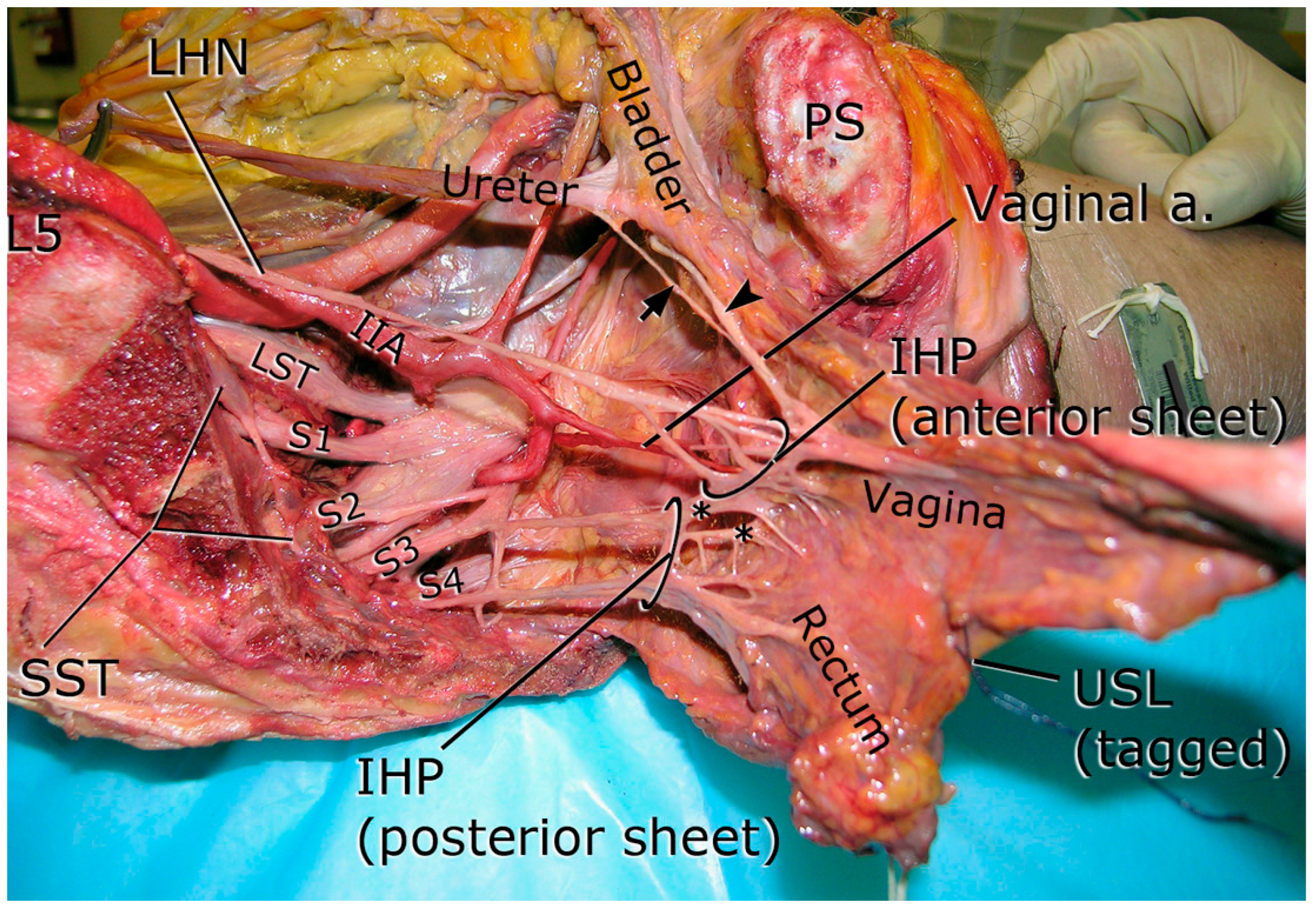 Surgeries 06 00094 g004 Surgeries 06 00094 g004