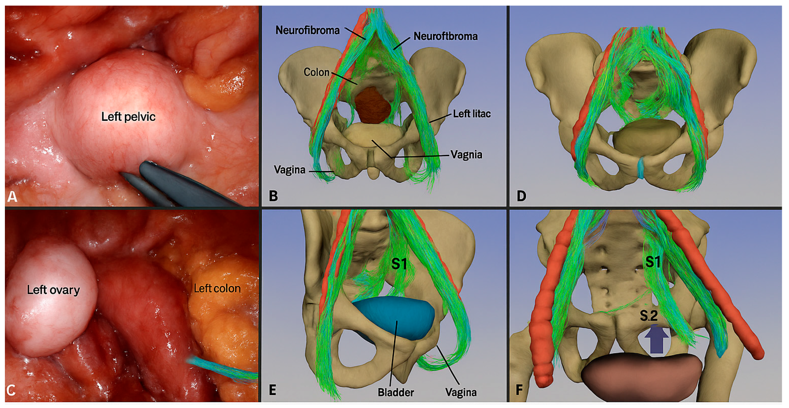 Surgeries 06 00094 g005 Surgeries 06 00094 g005