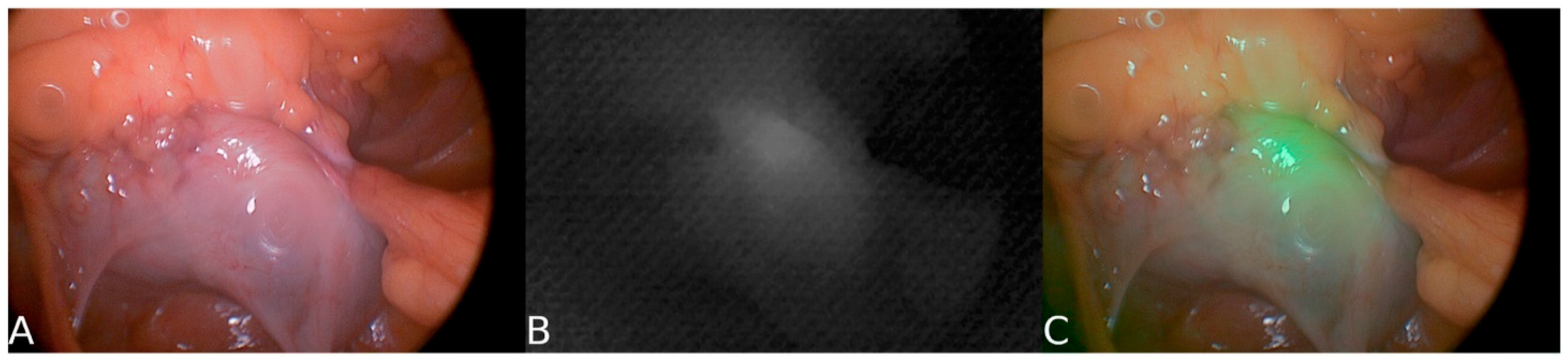 Surgeries 06 00094 g006 Surgeries 06 00094 g006