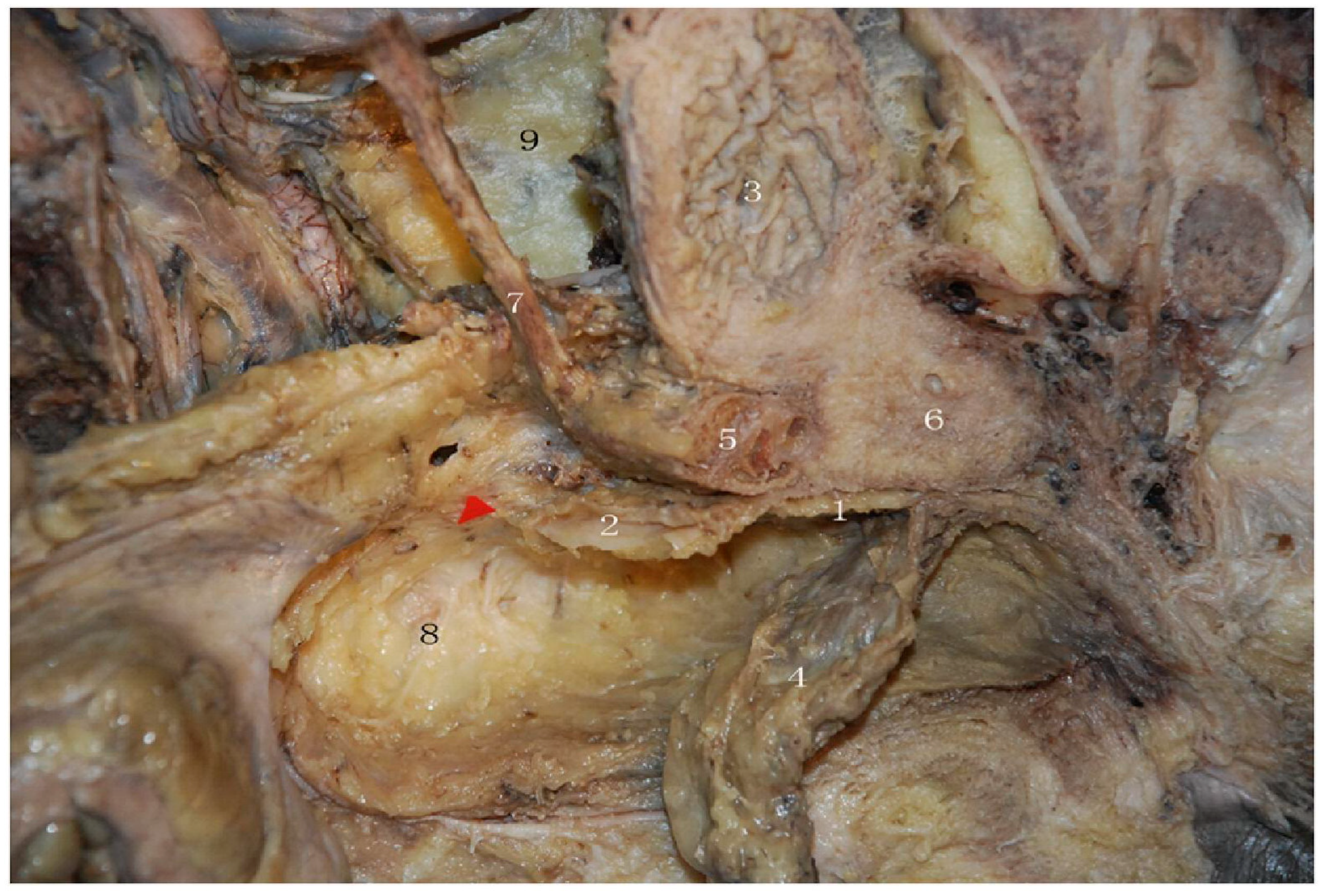 Surgeries 06 00094 g007 Surgeries 06 00094 g007