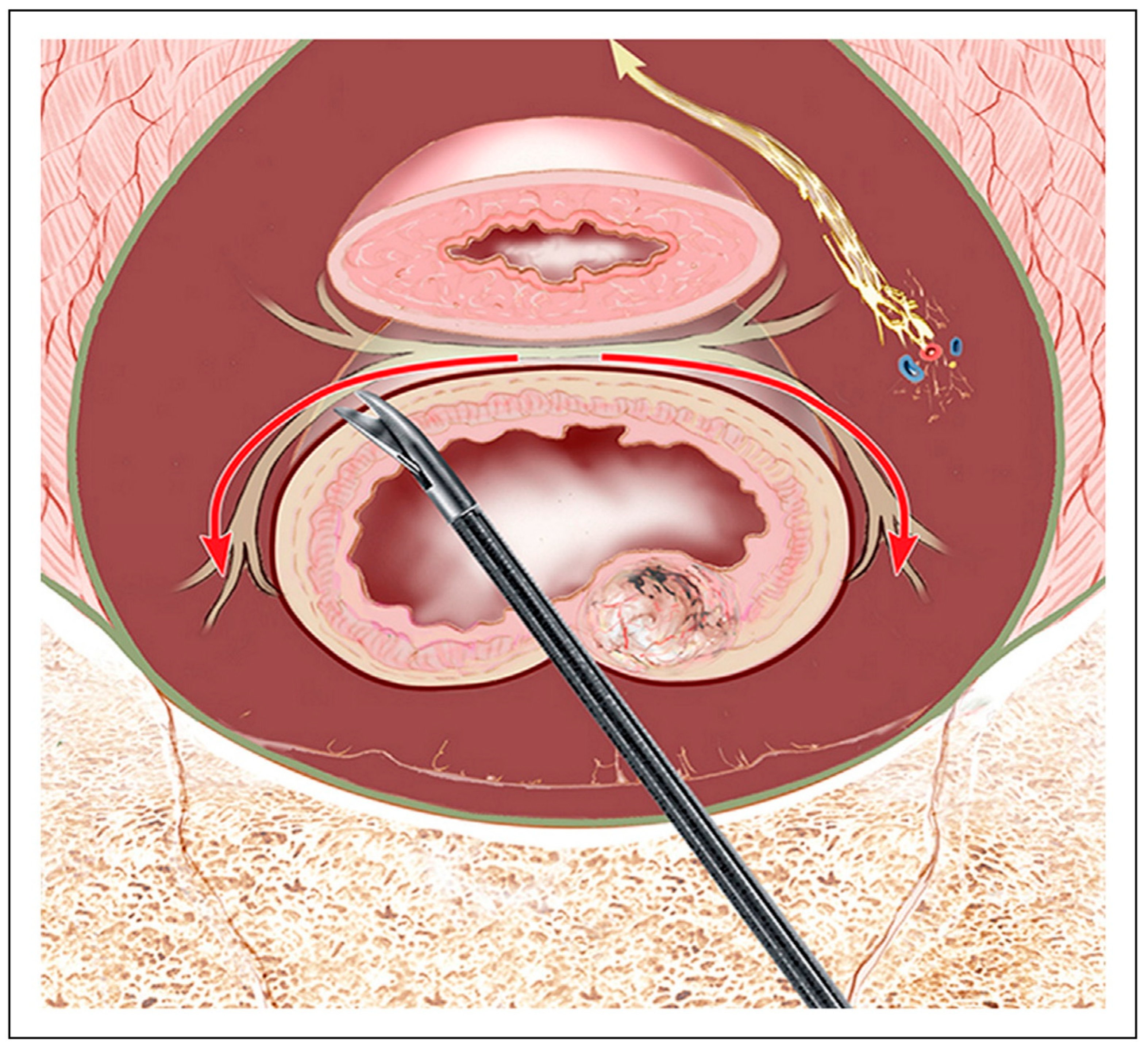 Surgeries 06 00094 g008 Surgeries 06 00094 g008