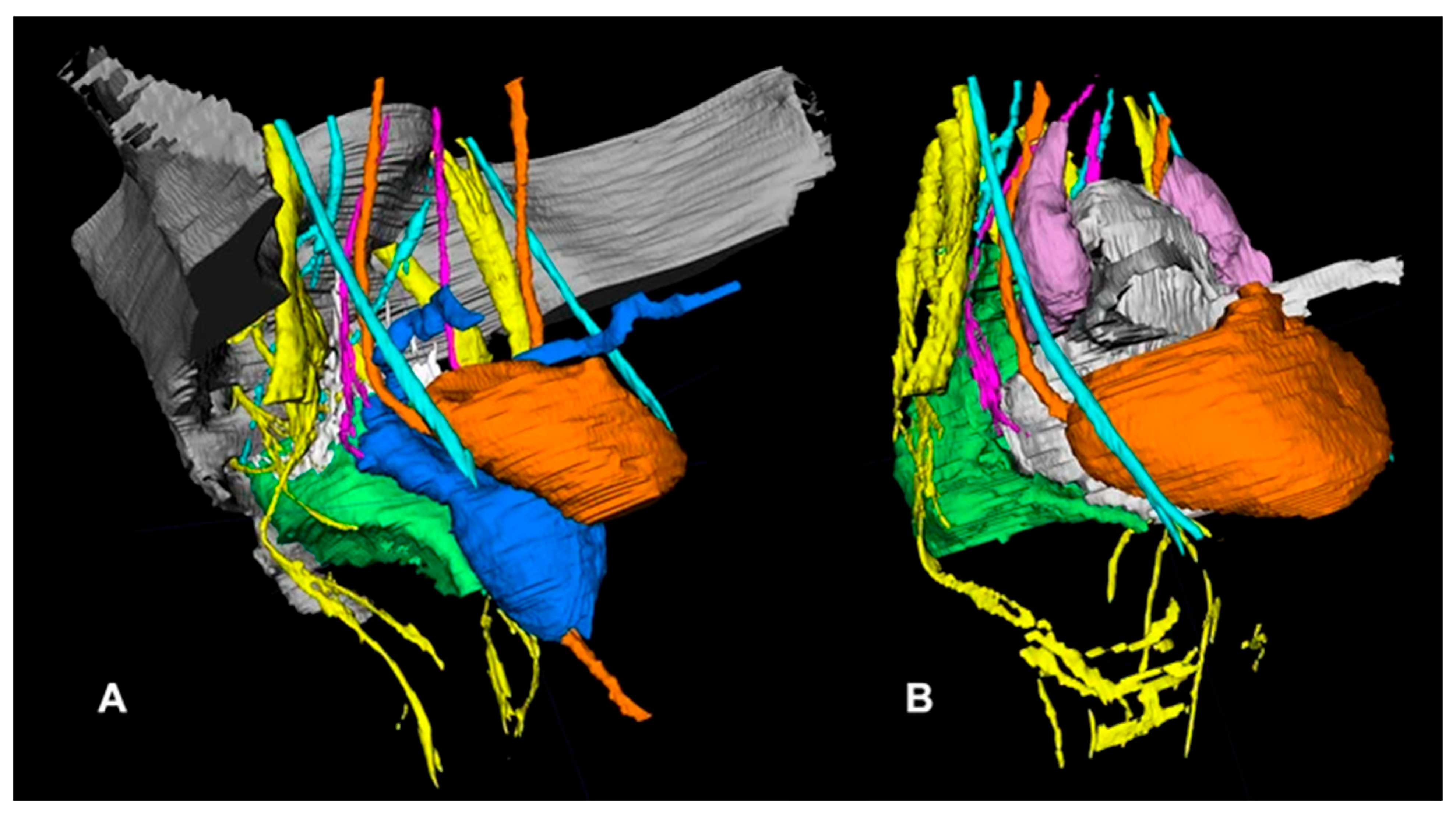 Surgeries 06 00094 g009 Surgeries 06 00094 g009