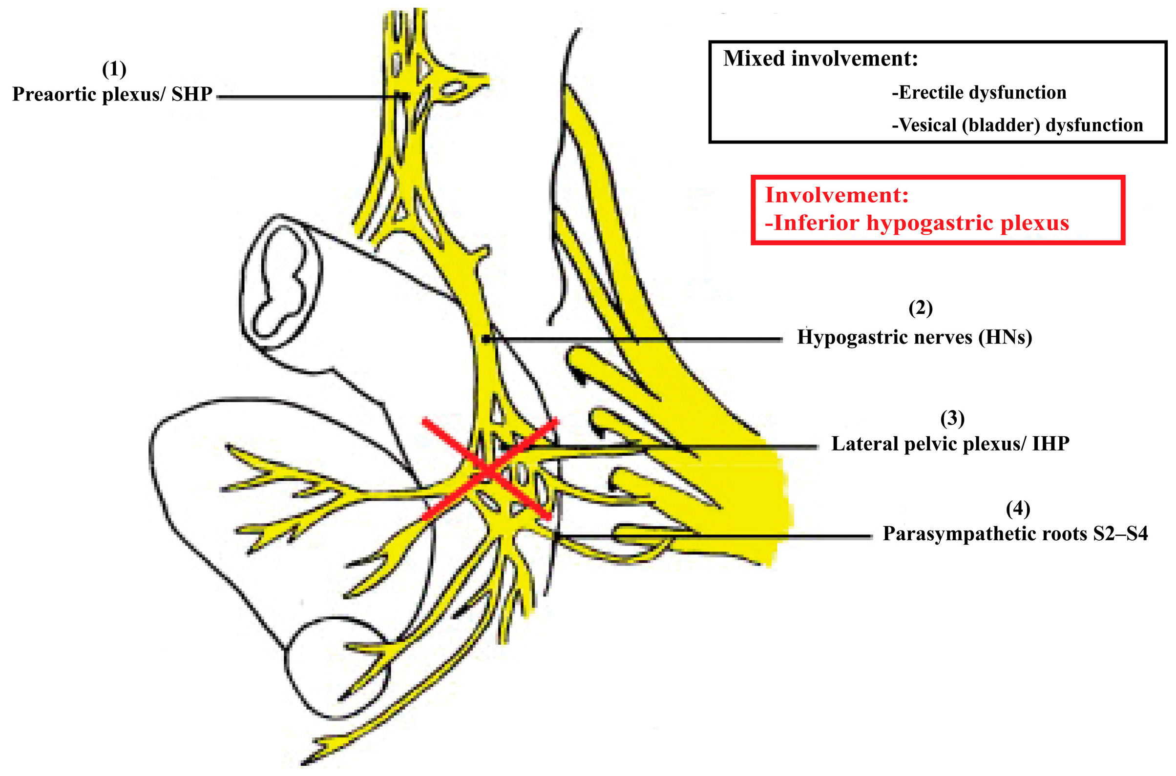 Surgeries 06 00094 g010 Surgeries 06 00094 g010