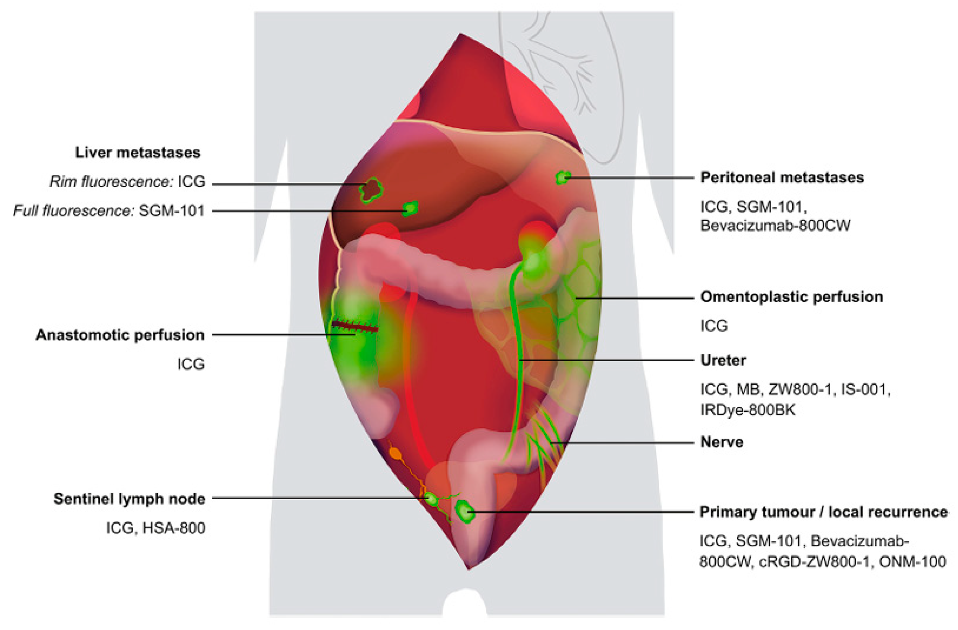Surgeries 06 00094 g012 Surgeries 06 00094 g012