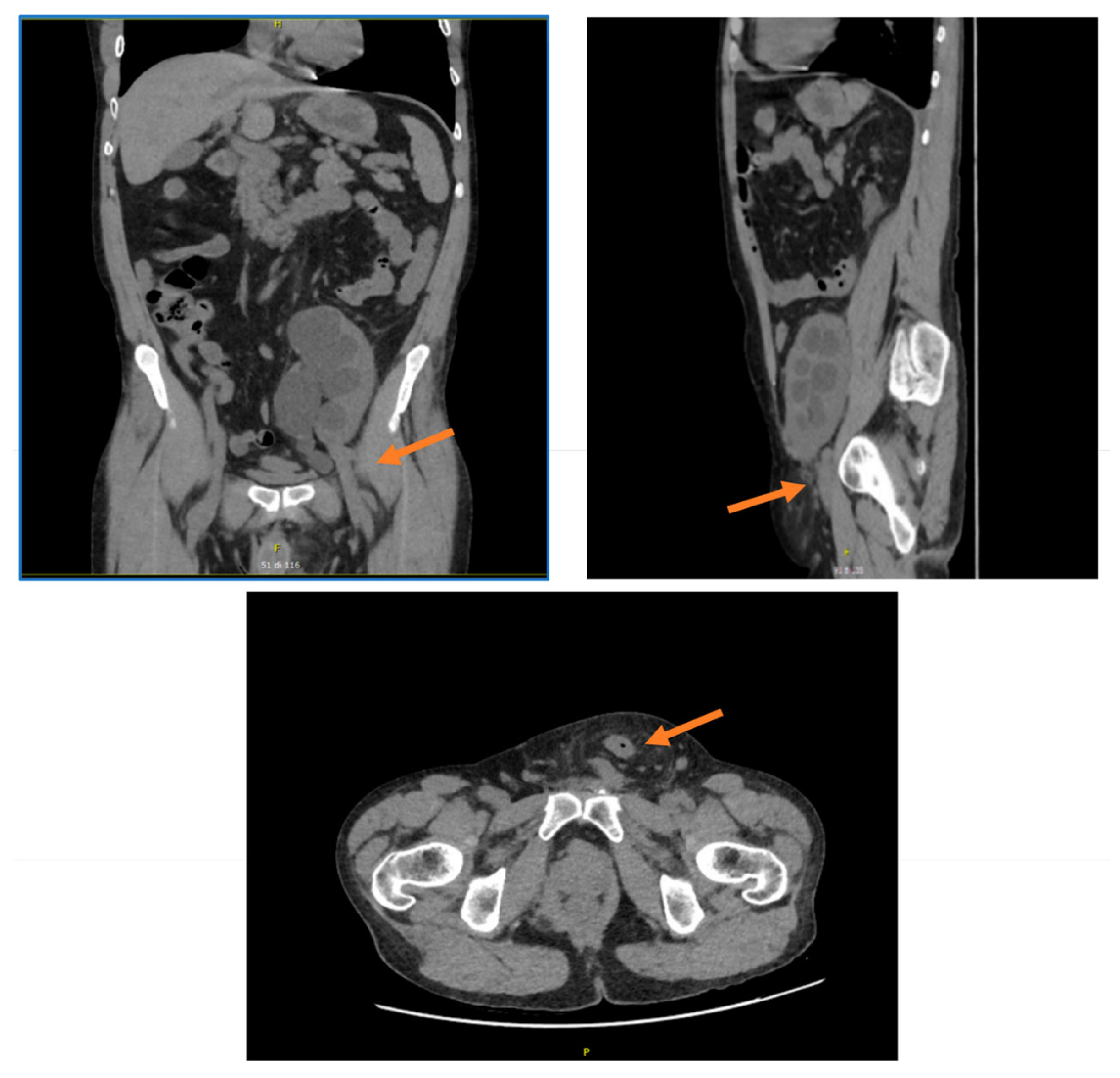 Surgeries 06 00097 g002