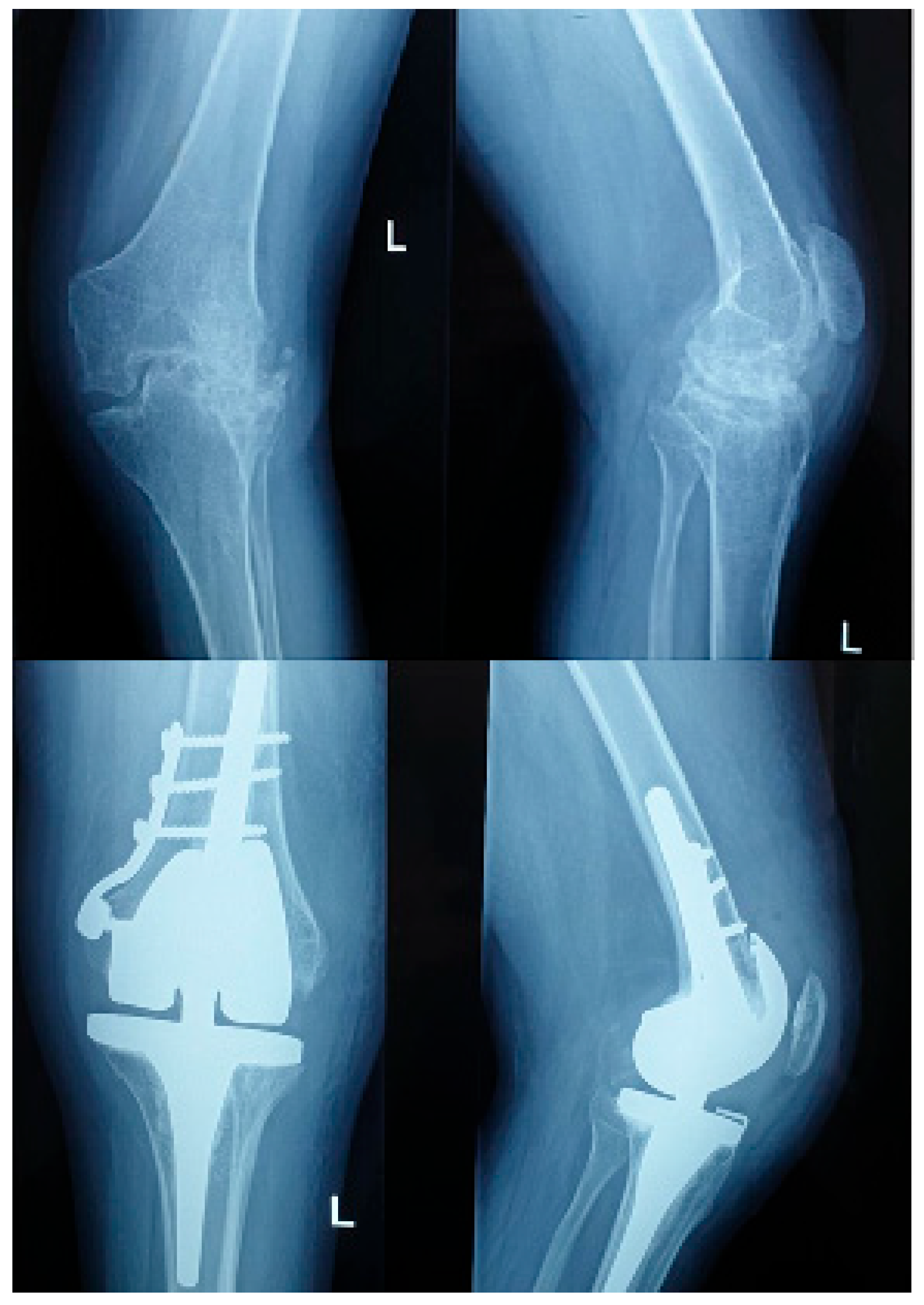 Surgeries 06 00101 g001